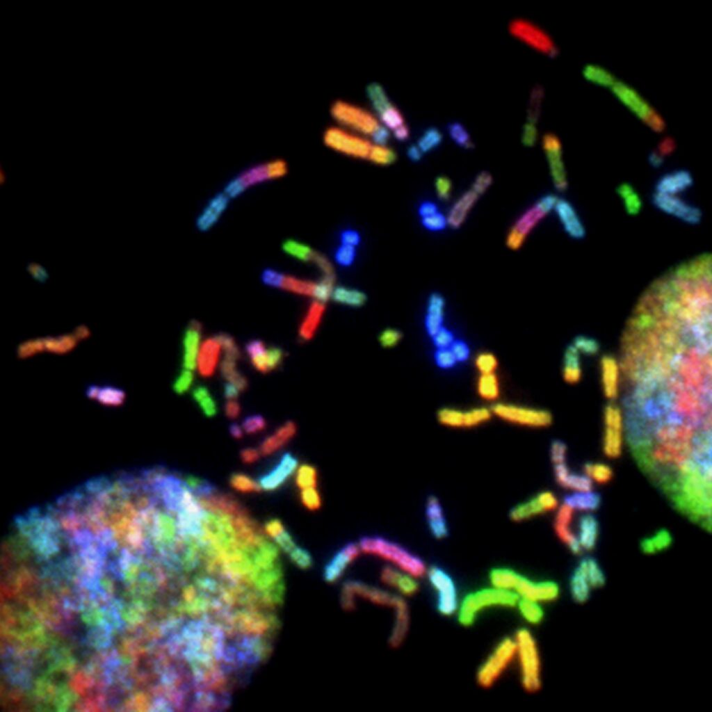 Molecular chaperones in neurodegeneration