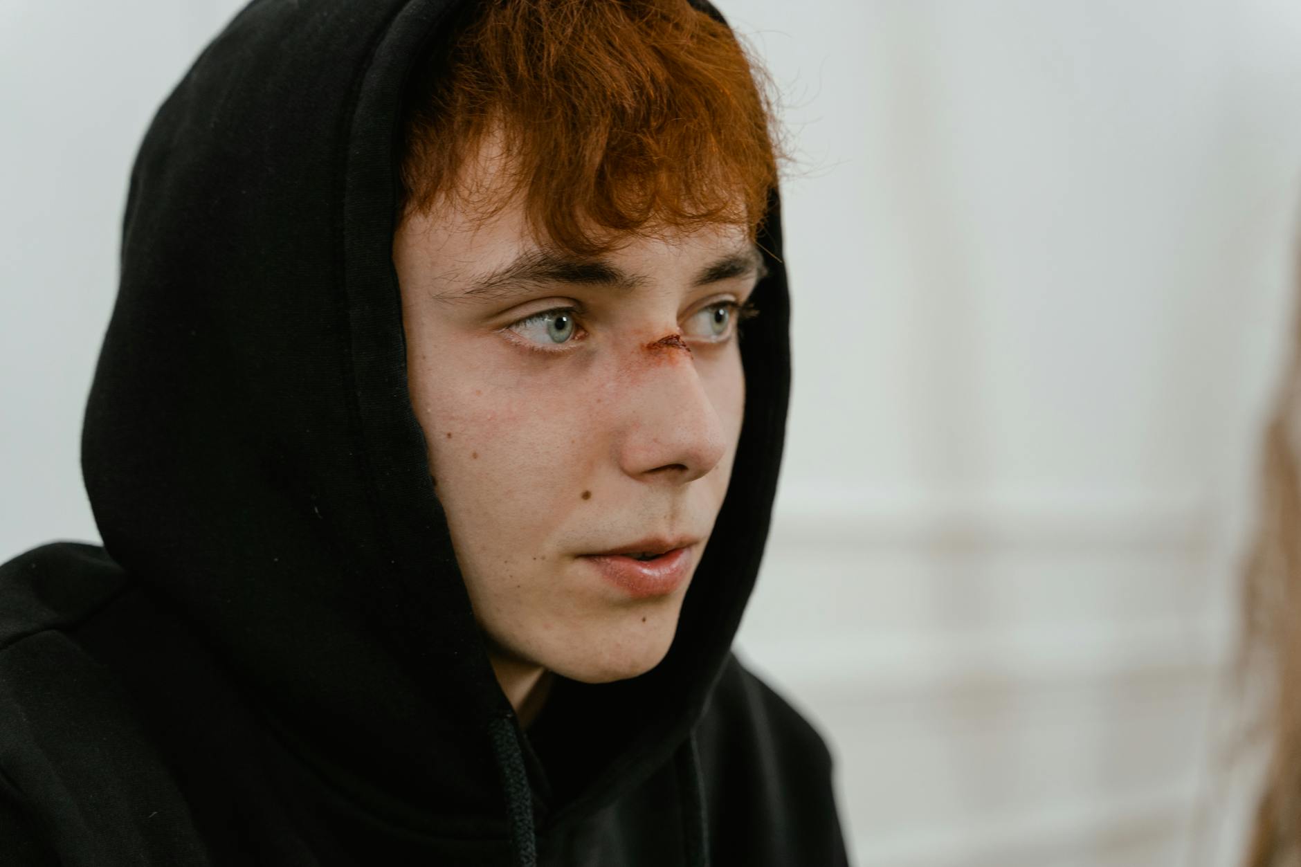 How Do Serious Injuries Increase Parkinson's Disease Risk?