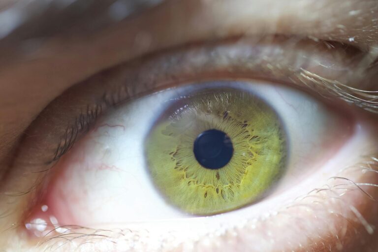 What are the common eye diseases in people over 60 - Featured image