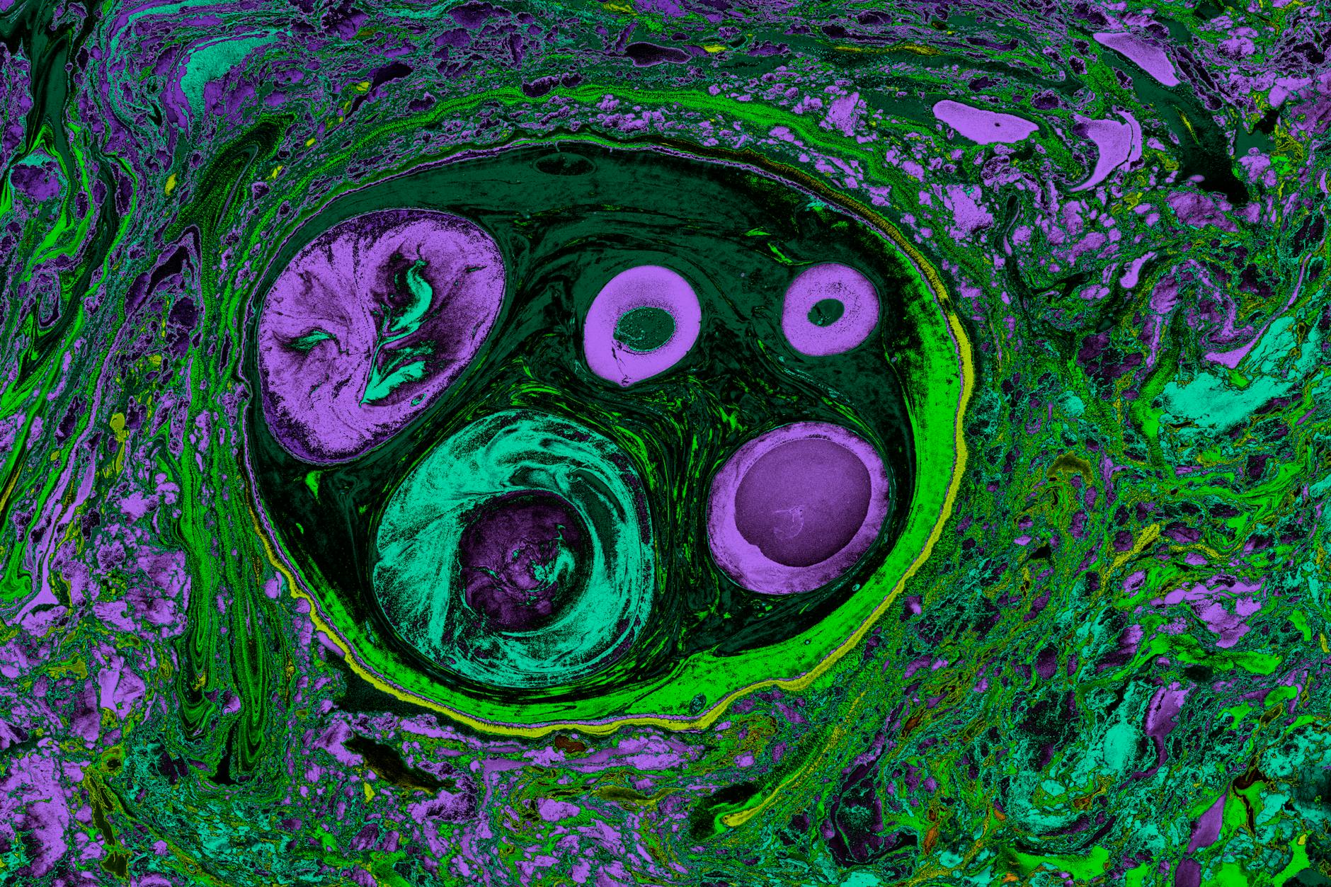 What Does Alcohol Actually Do to the Brain?