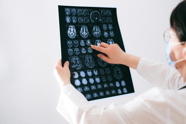 What does leukoaraiosis mean on a brain scan - Featured image