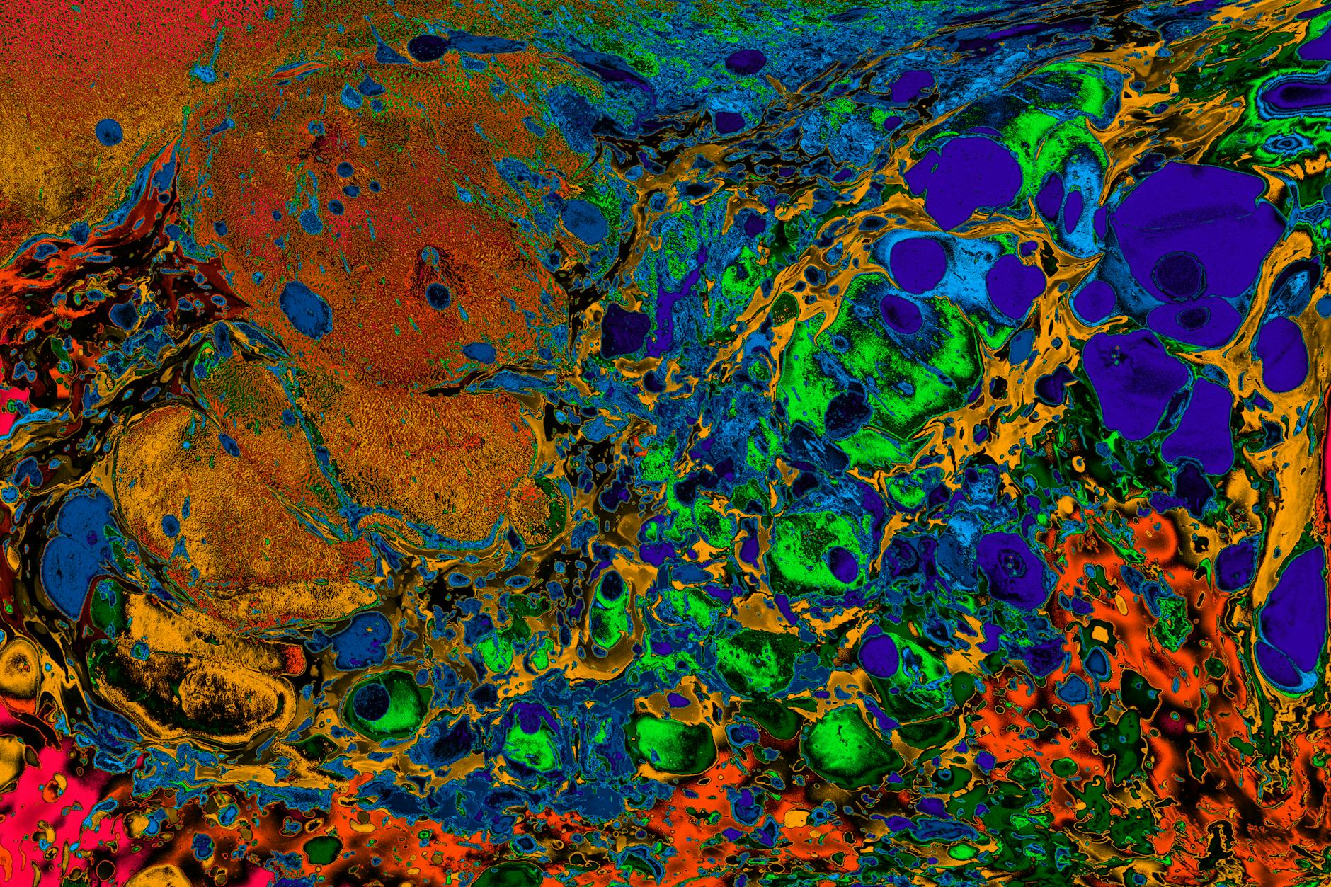 What Happens Inside a Centenarian's Brain