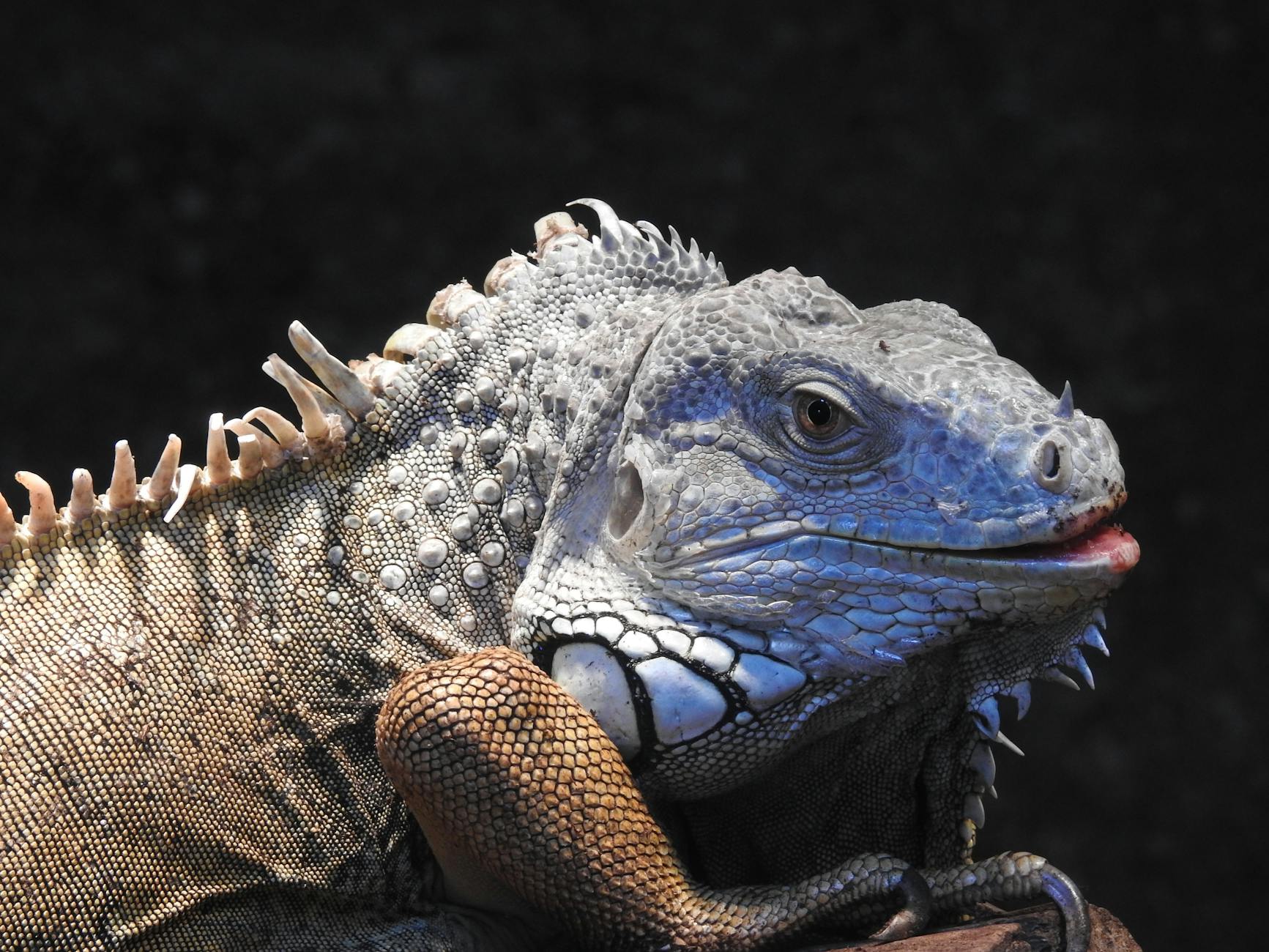 What Is the GDS Scale and How Does It Measure Dementia Severity?