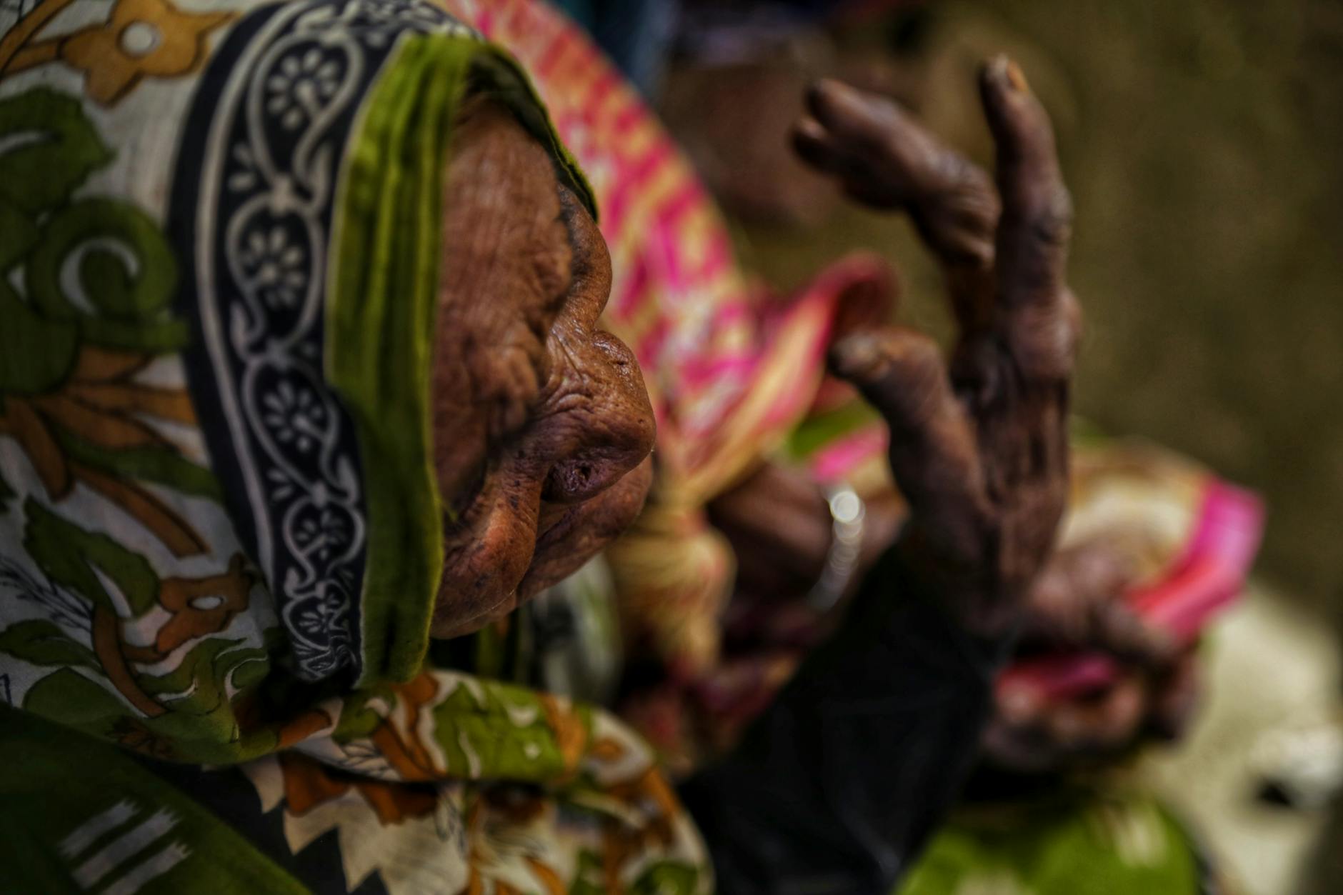 Why Are Seniors at Such High Risk for Blood Clots?