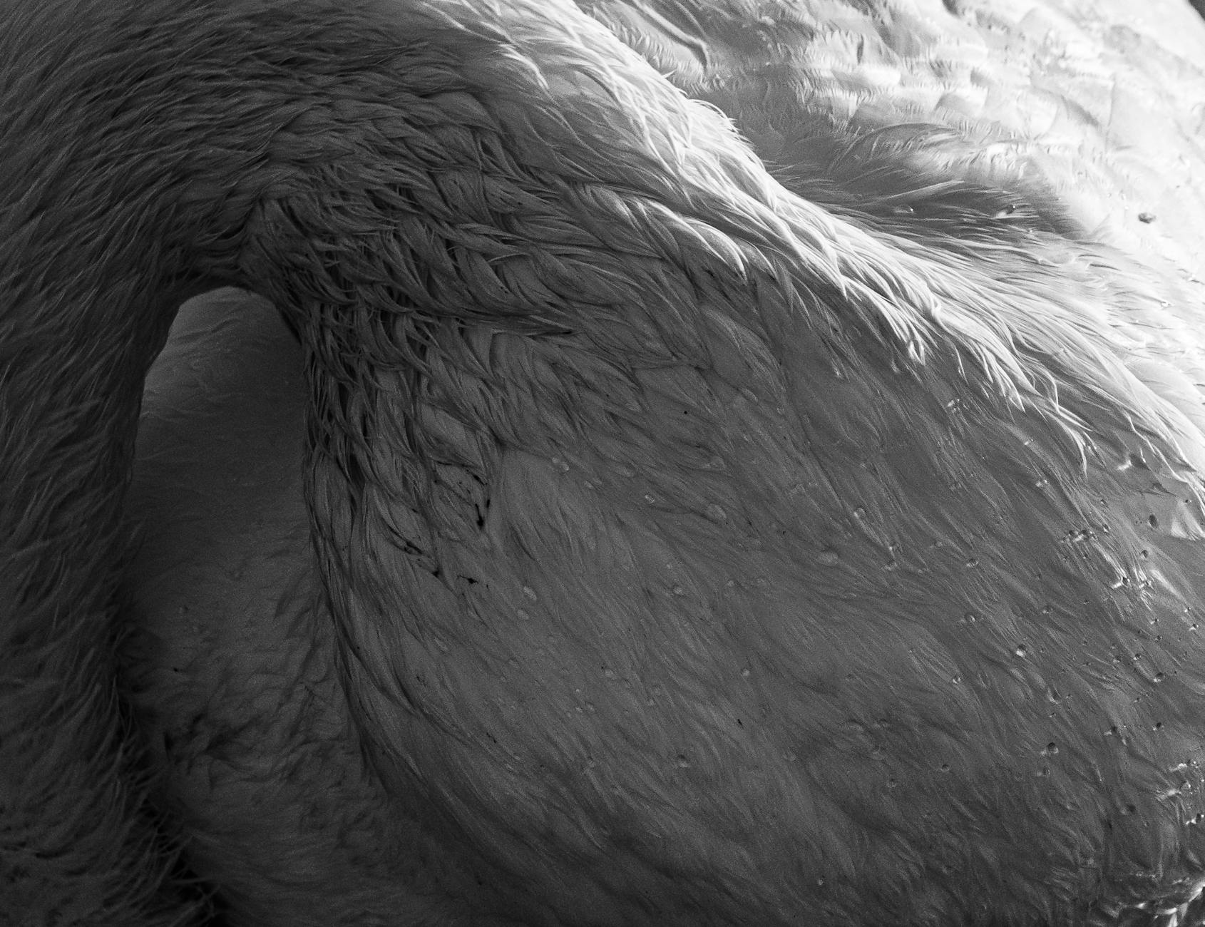 Why Do Falls Occur So Frequently in Parkinson's Disease?