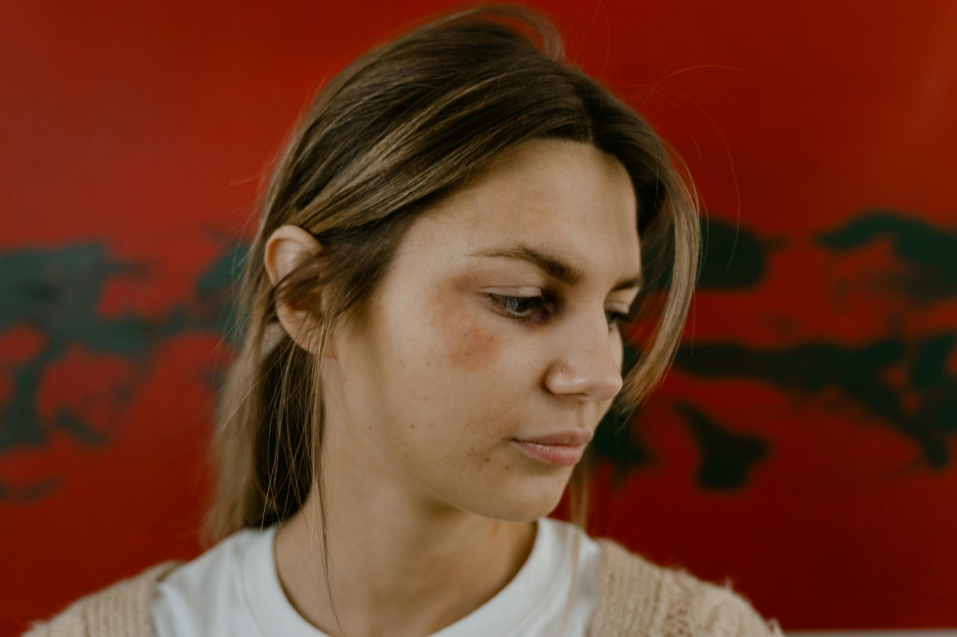 Why Is the Brain So Vulnerable to Oxidative Damage, and What Do Antioxidants Actually Do?