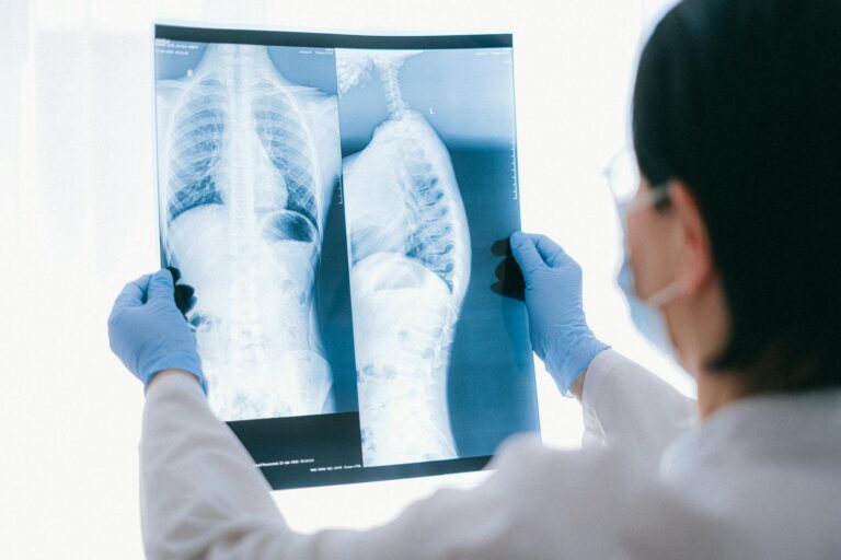 7 Risk Factors Spine Doctors Say Increase Your Chances of Disc Herniation After Age 30 - Featured image
