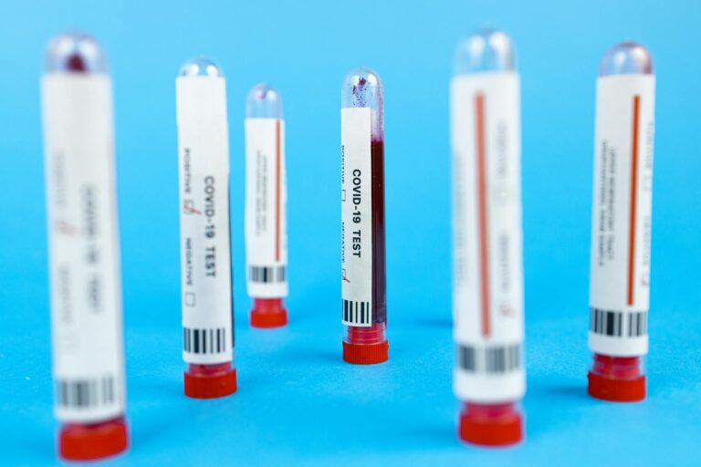 Blood Test Interfering Drug: What to Stop Before Your Lab Work - Featured image
