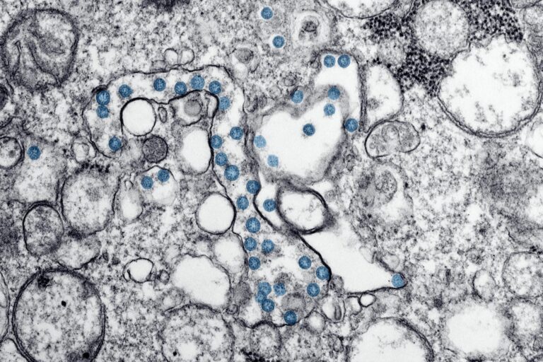 BMP4 Signaling Between Brain Cells May Protect Against Alzheimer's - Featured image