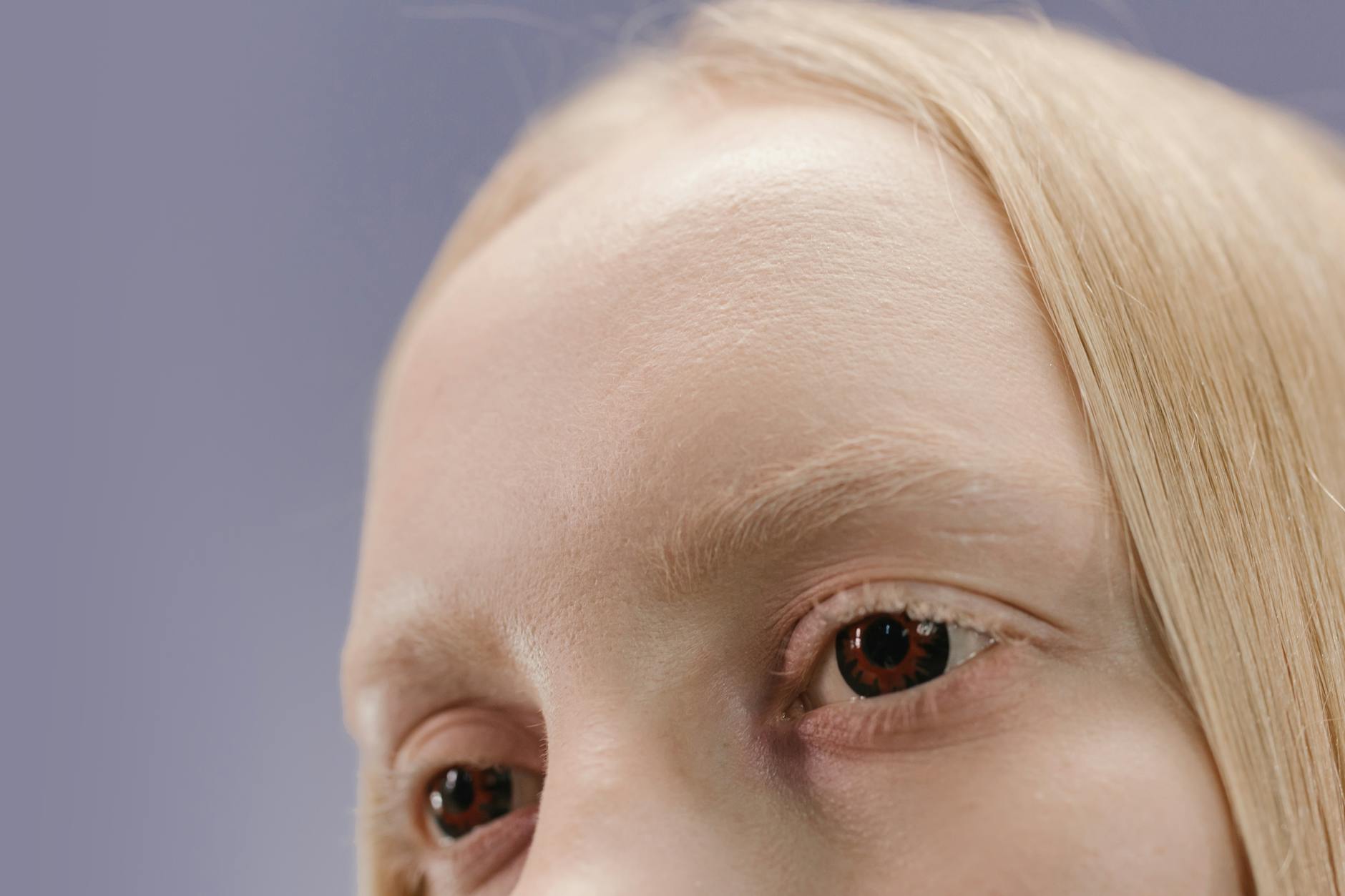 Chronic, Dull Aching Pain—The Earliest Warning Sign of Disc Degeneration