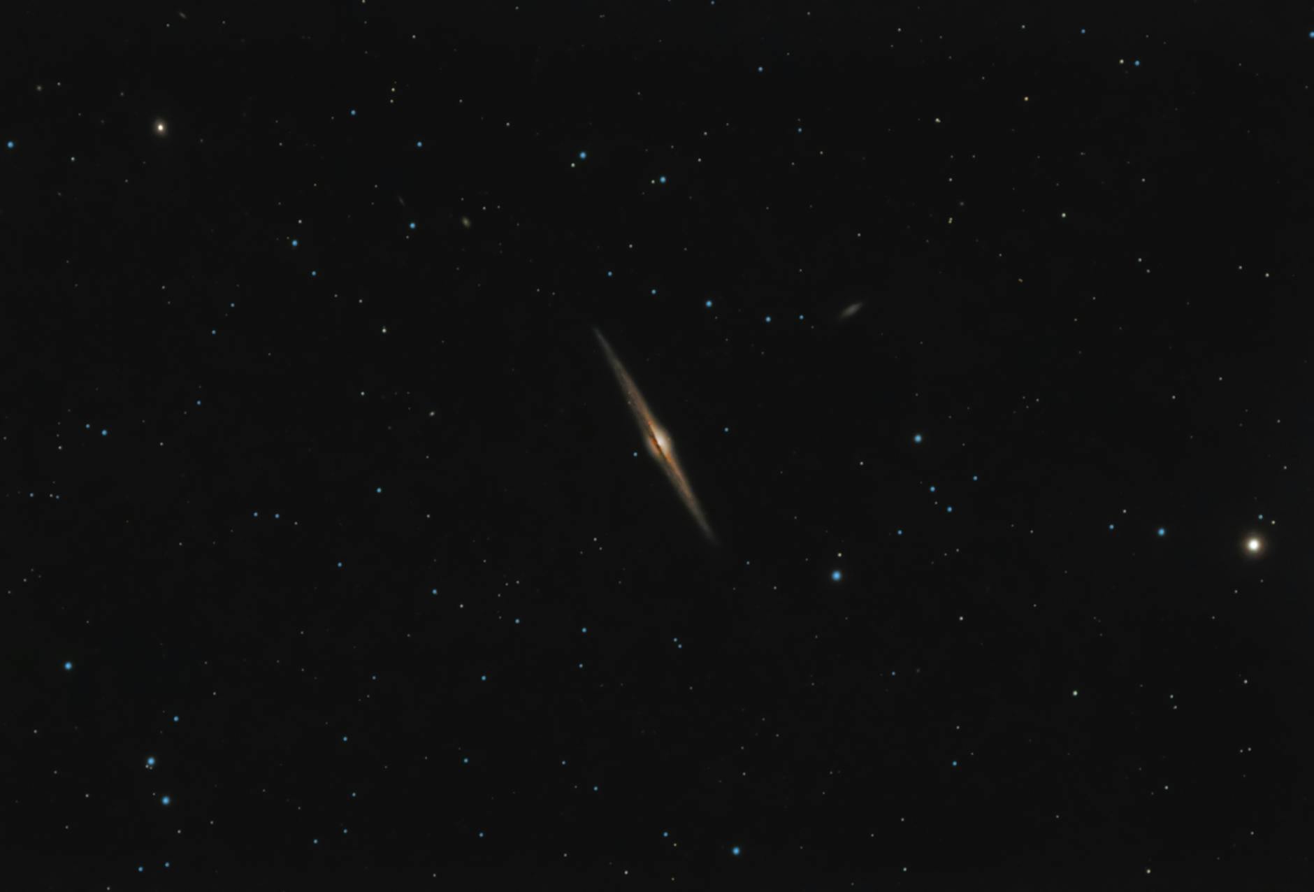 Corticosteroid Exposure and Why It Matters for Brain Health