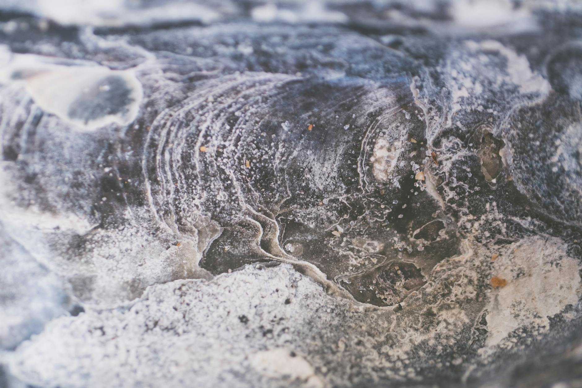 Degenerative Disc Disease and Age-Related Changes