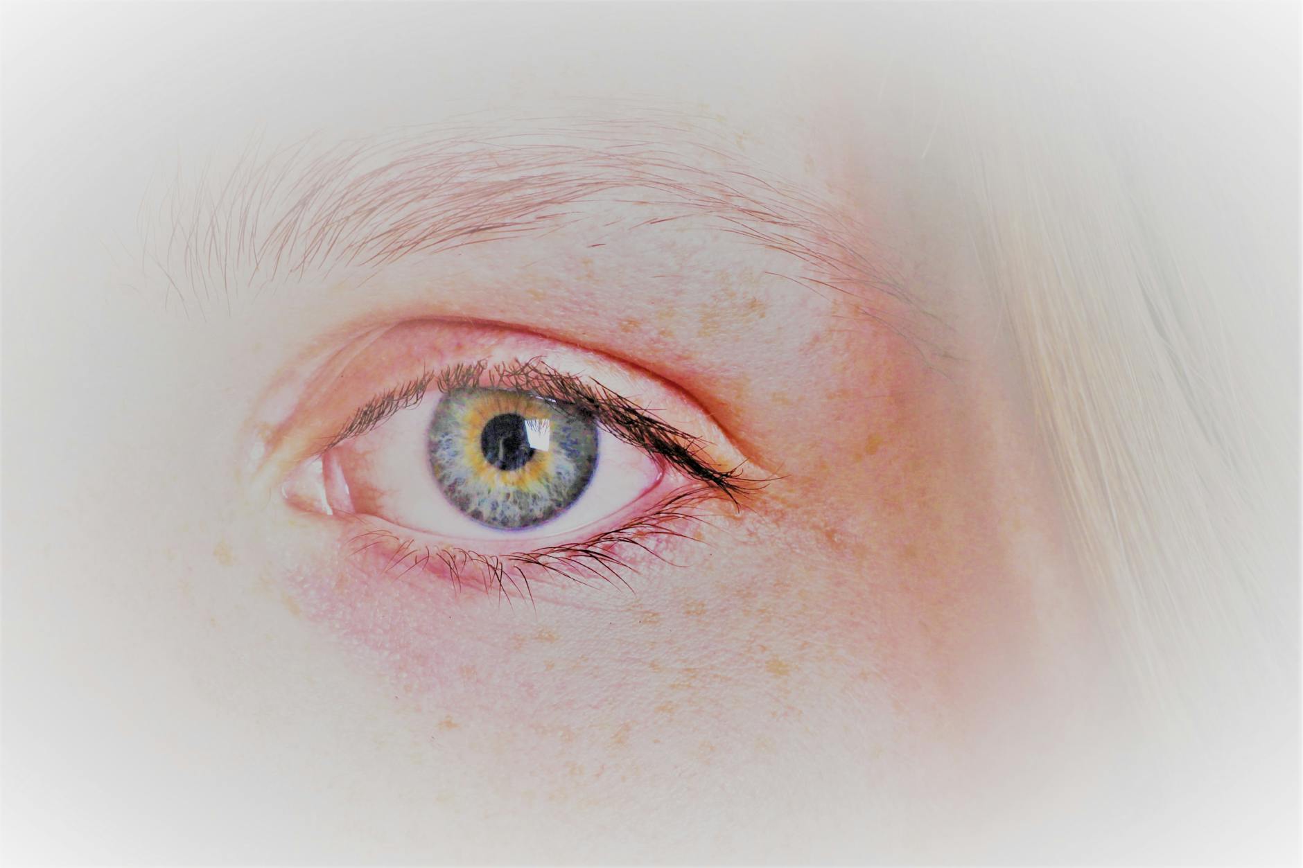 Heightened Sensitivity and the Paradox of Nerve Compression Pain