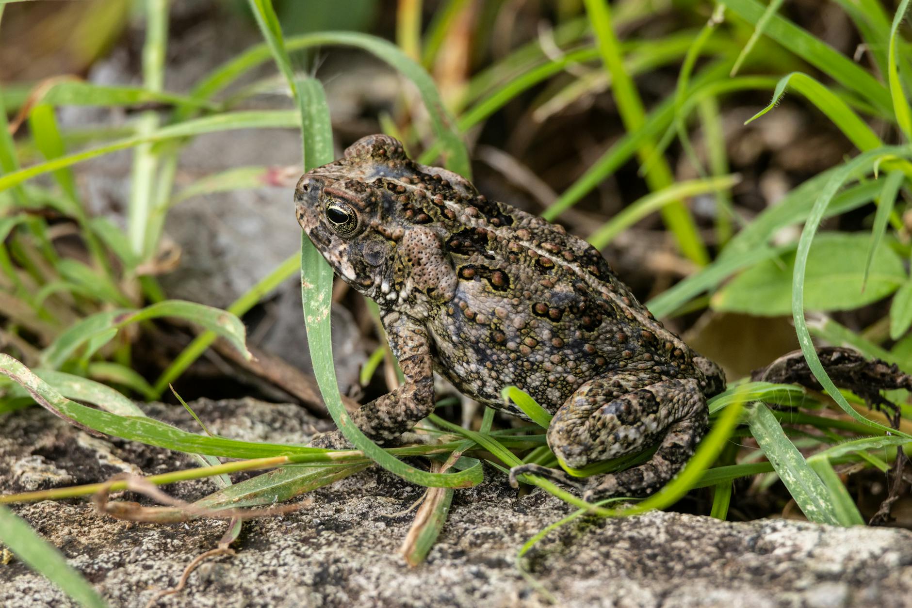 How Common Is Back Pain Really and Who Gets It?