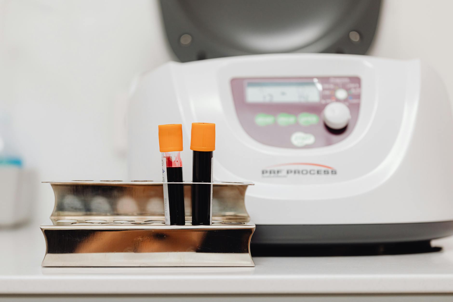 How Do Blood Tests Compare in Accuracy to Brain Imaging?