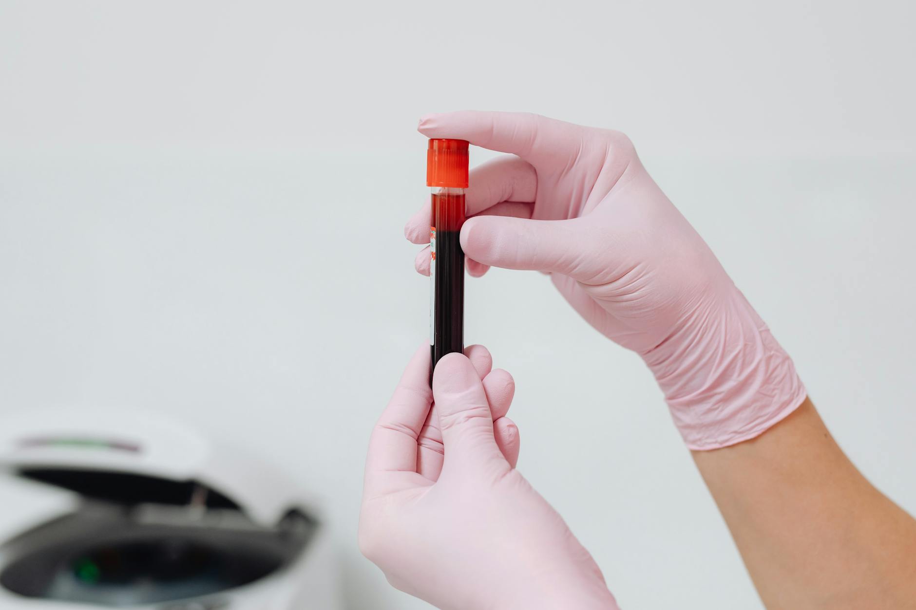 How Do Blood Tests Detect Alzheimer's and Parkinson's Before Symptoms?