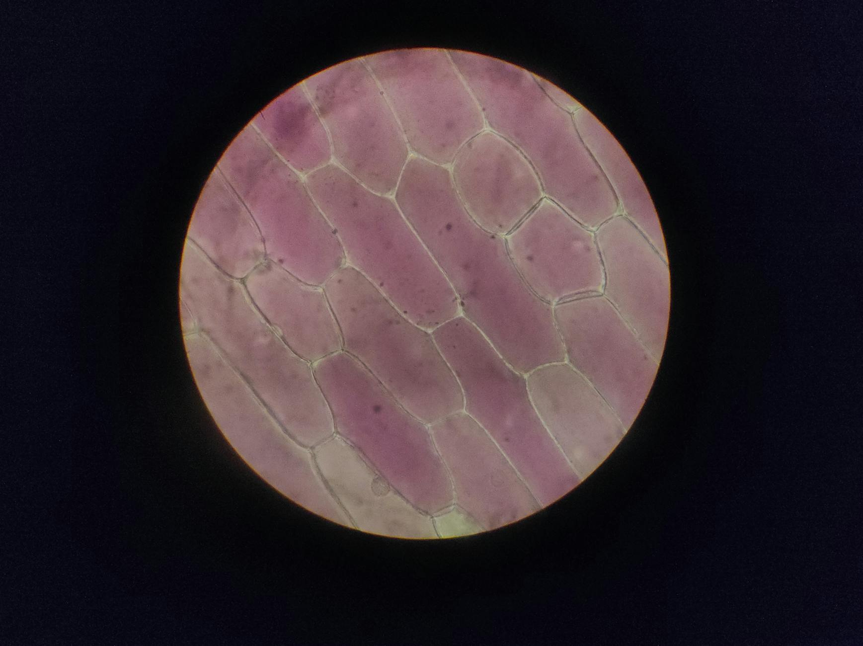 How Do Brain Cells Communicate to Protect Against Alzheimer's?