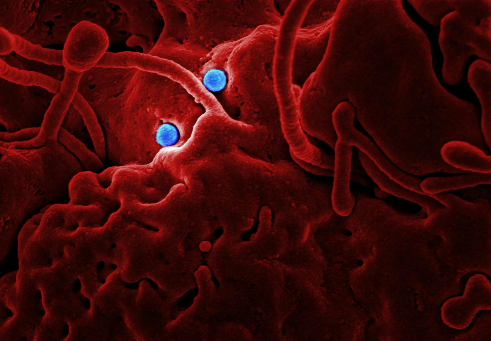 How Do Brain Cells Defend Against Toxic Tau Proteins?