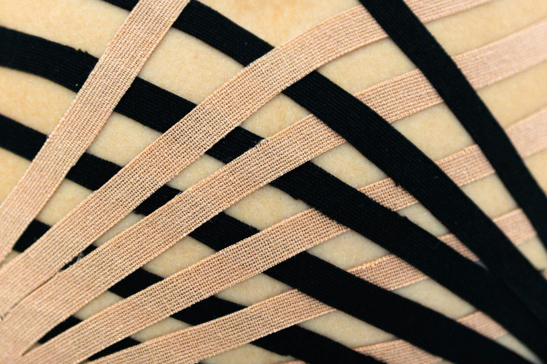 How Does a Disc Herniation Actually Occur Inside Your Spinal Column?