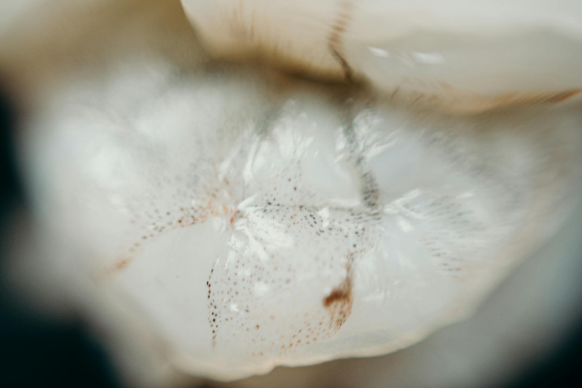 How Does a Herniated Disc Compress Nerves and Cause Leg Pain?