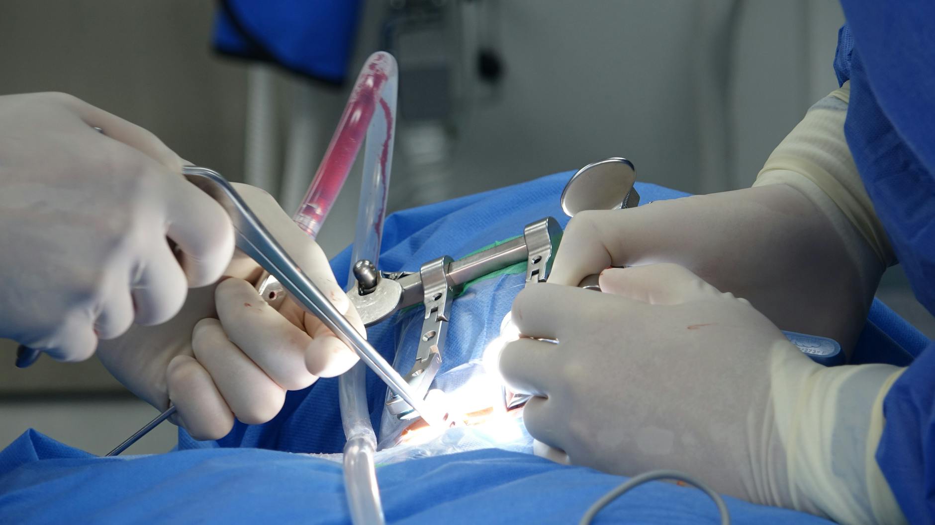 How Smoking Starves Your Spinal Discs of What They Need