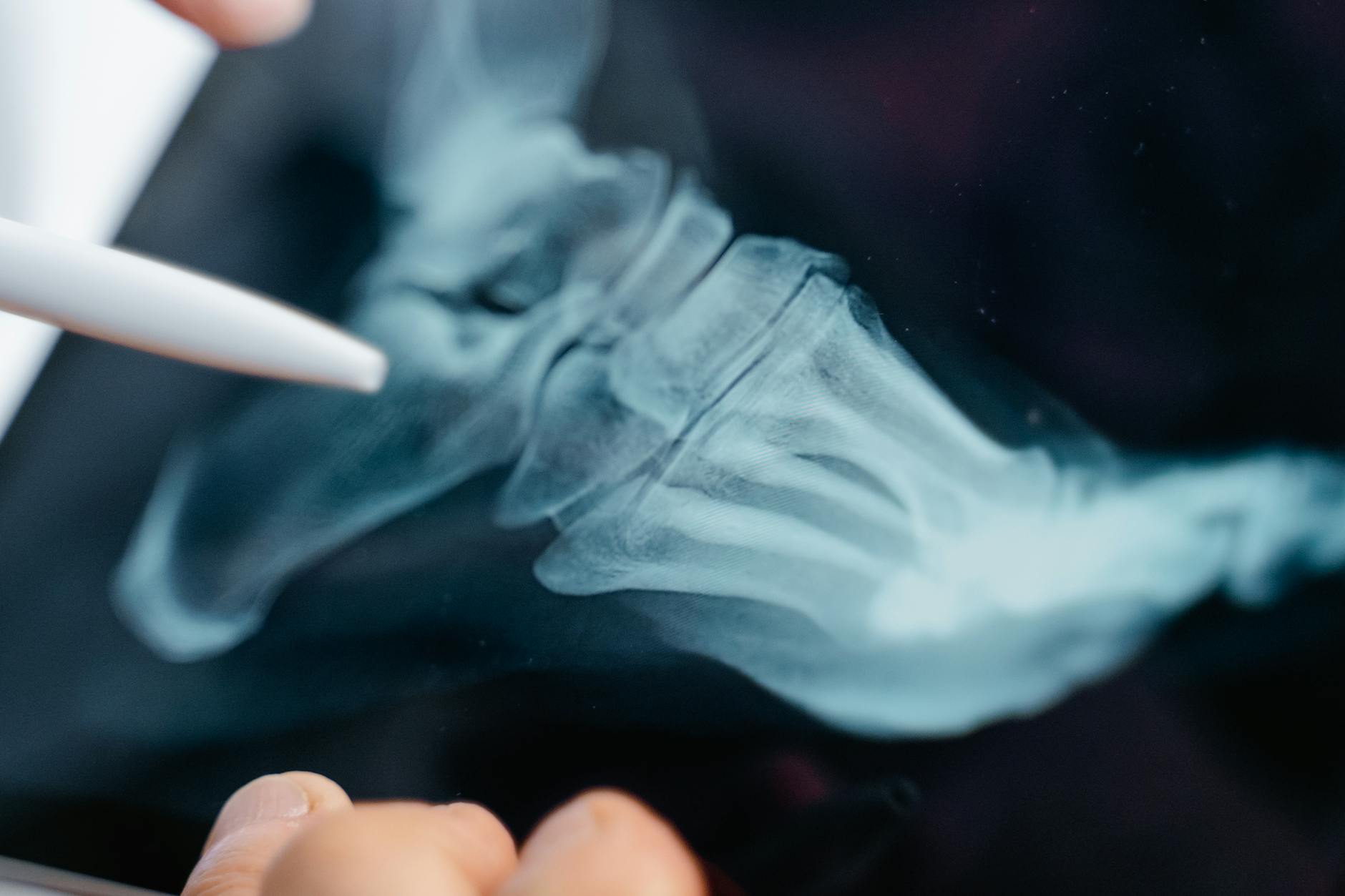 Key Treatment and Diagnostic Advances Being Highlighted