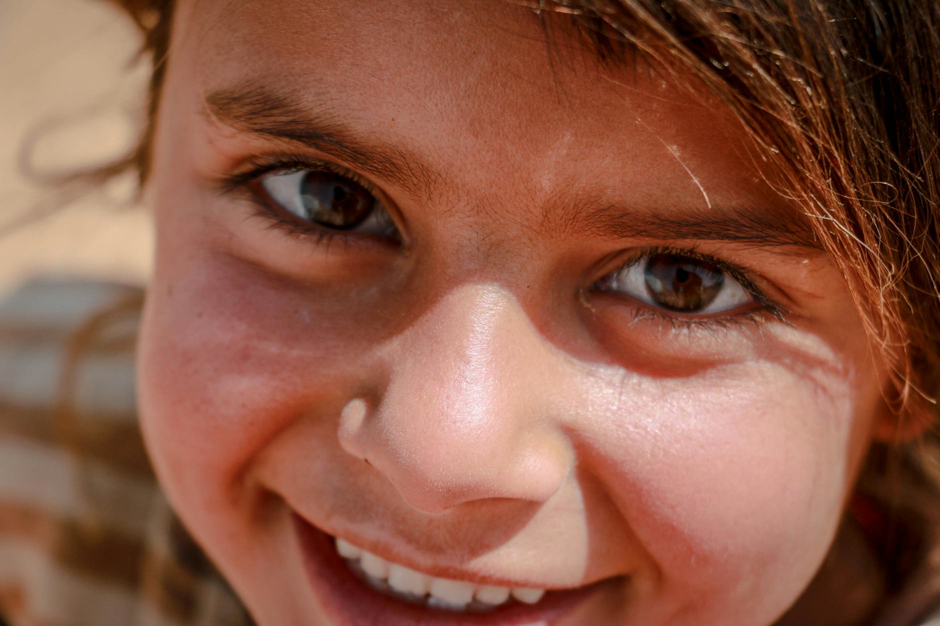 Limping or Altered Gait When You Walk