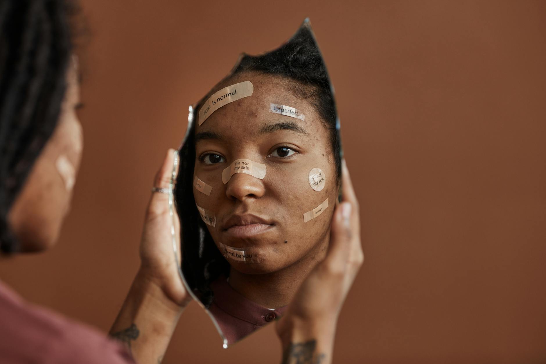 Oily Skin Types and Vulnerability to Congestion