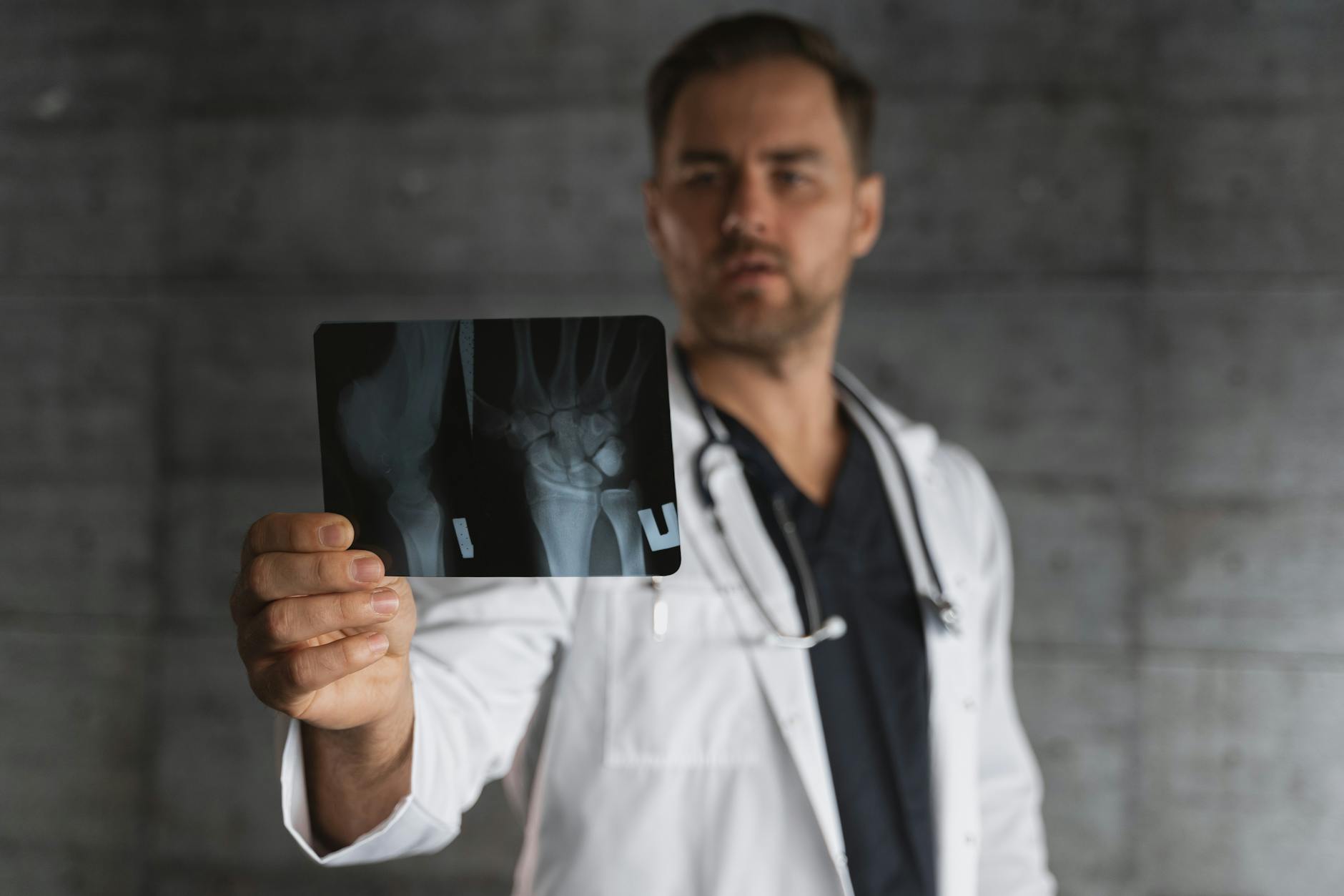 Spondylolisthesis and Compression Fractures — When Vertebrae Move or Break