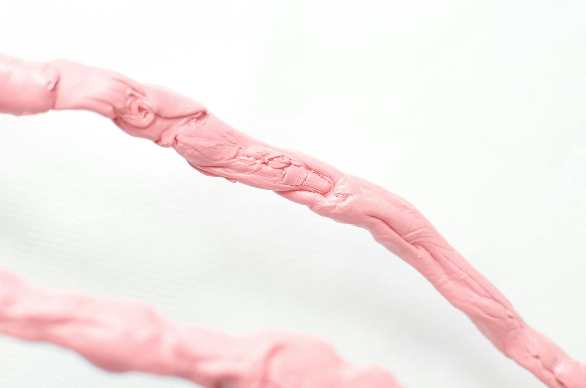 Stiffness and Reduced Mobility—The First Warning Sign