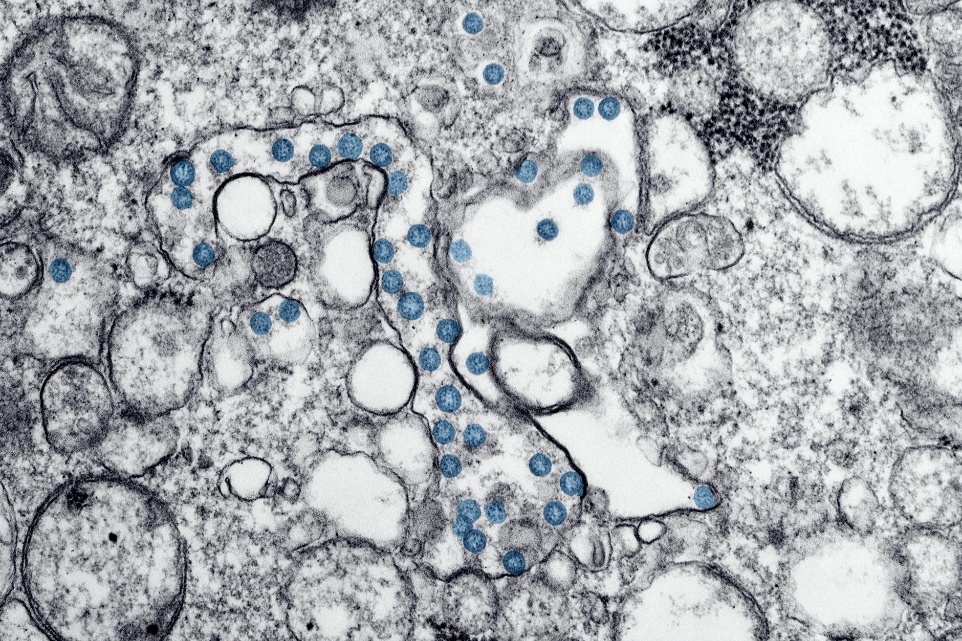 Tanycytes: Specialized Cells That Transport Tau Away From the Brain