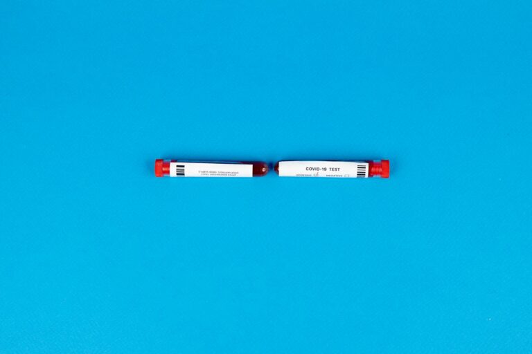 The Diagnostic Tests Used for SI Joint Pain - Featured image