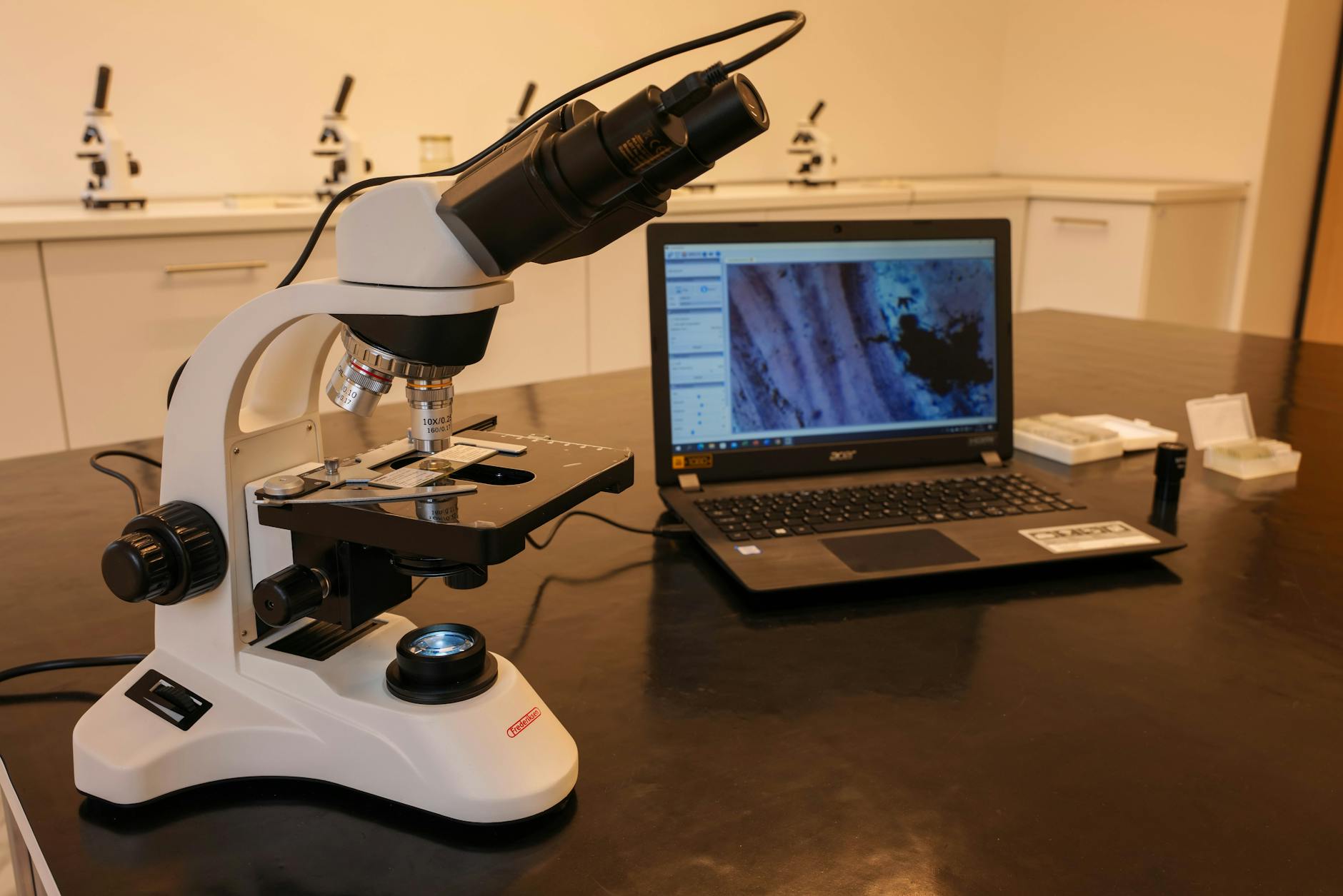 The Herpesvirus-Dementia Connection Researchers Are Investigating