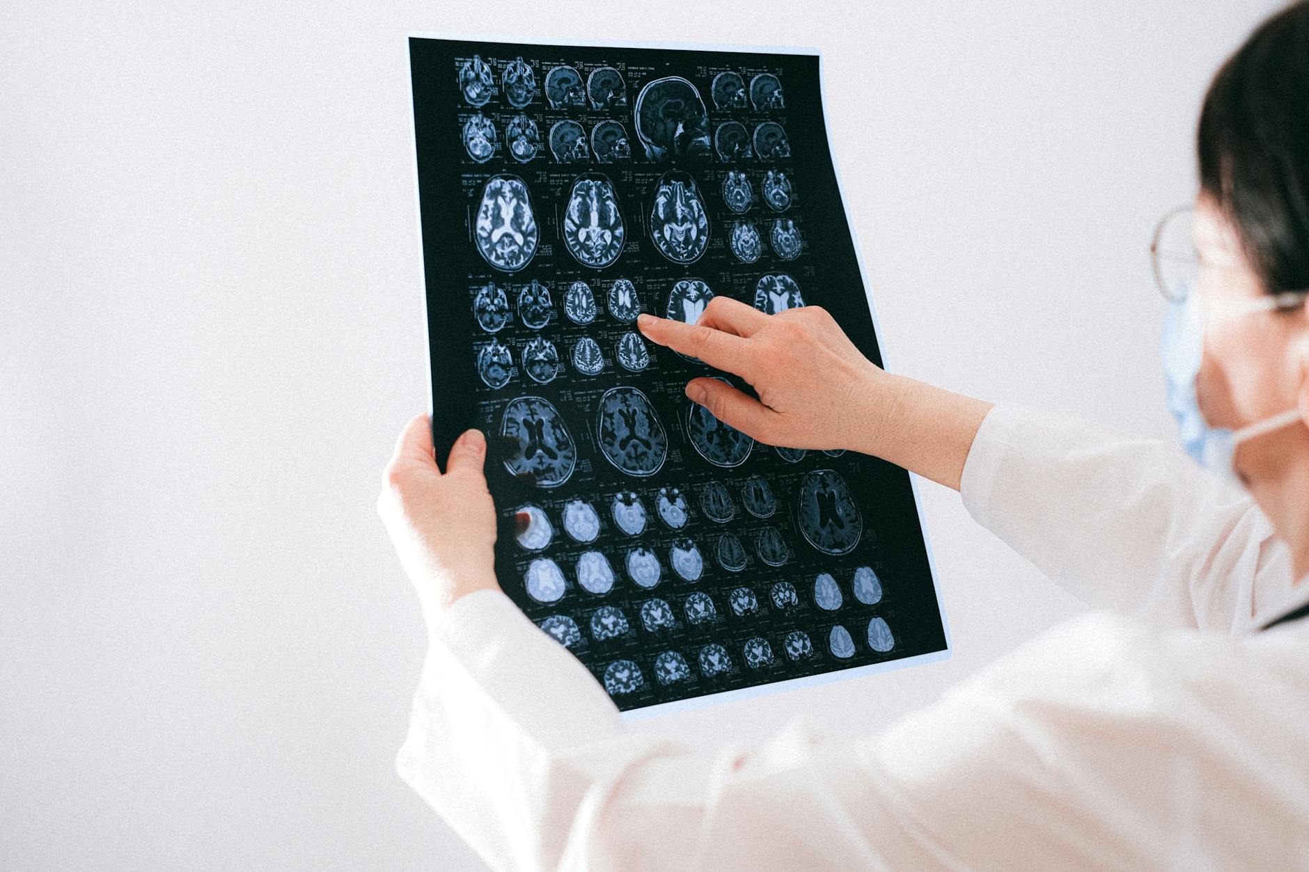 The Neurological Connection — Why Brain Health Sites Should Care
