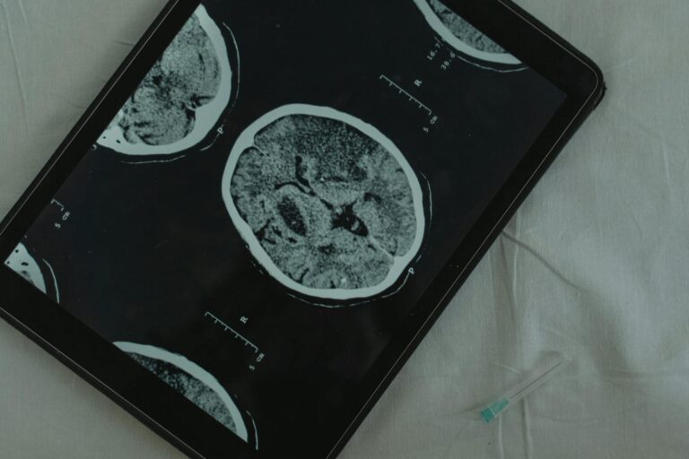 This "switch" in the brain may explain how Alzheimer's progresses - Featured image