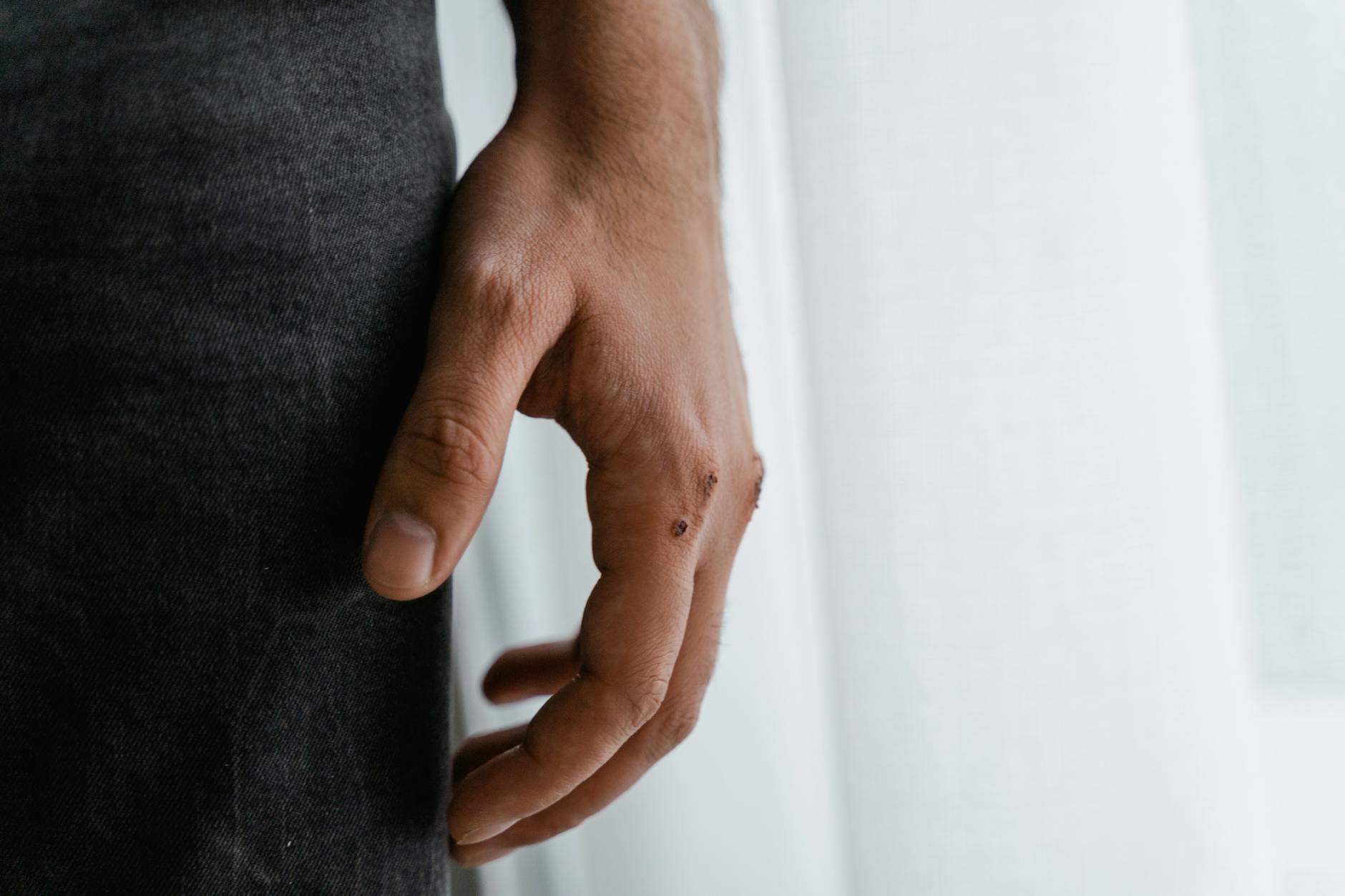 Violence and Gunshot Wounds as Significant but Preventable Causes