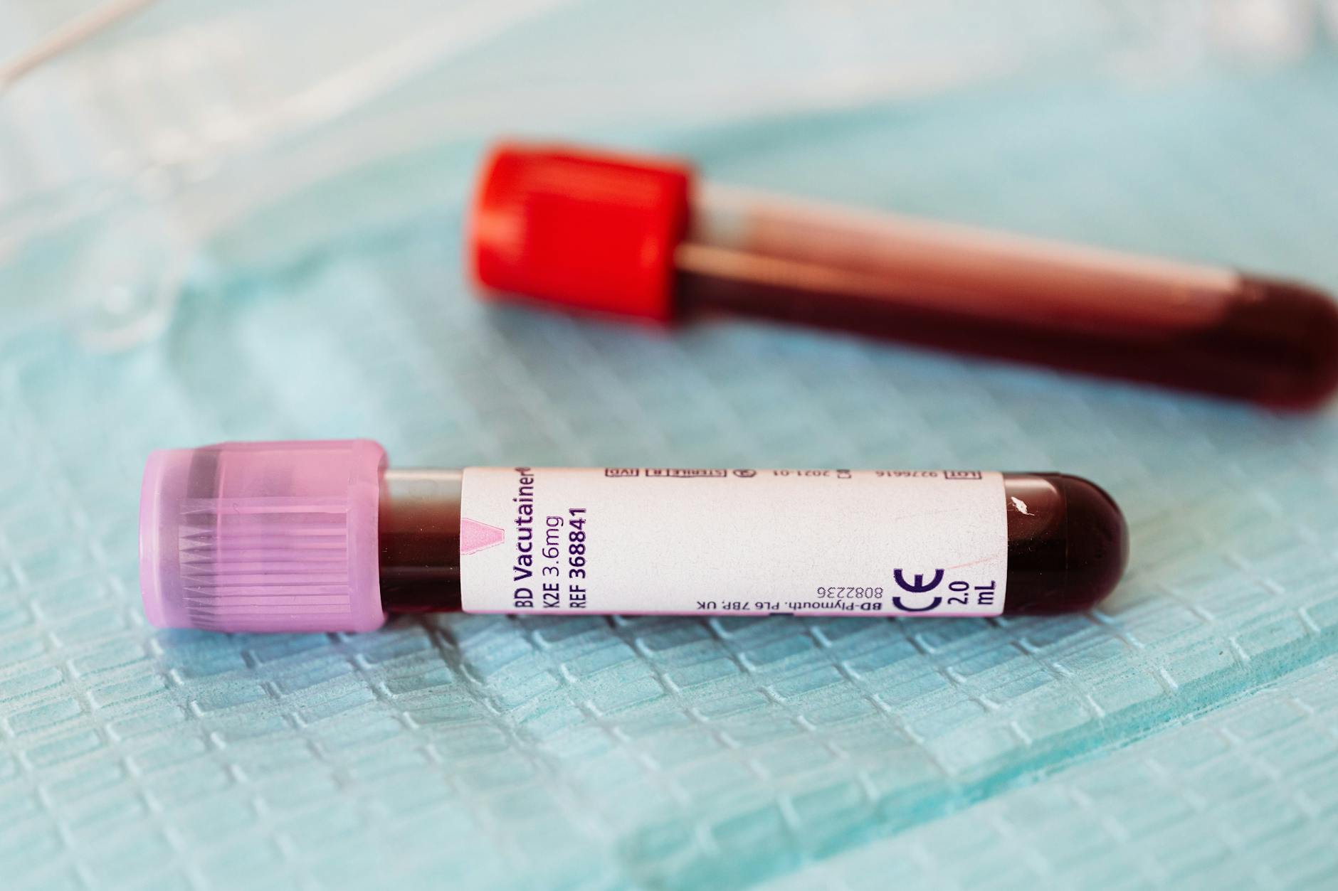 What Are Antibody Therapies Targeting in Alzheimer's Disease?