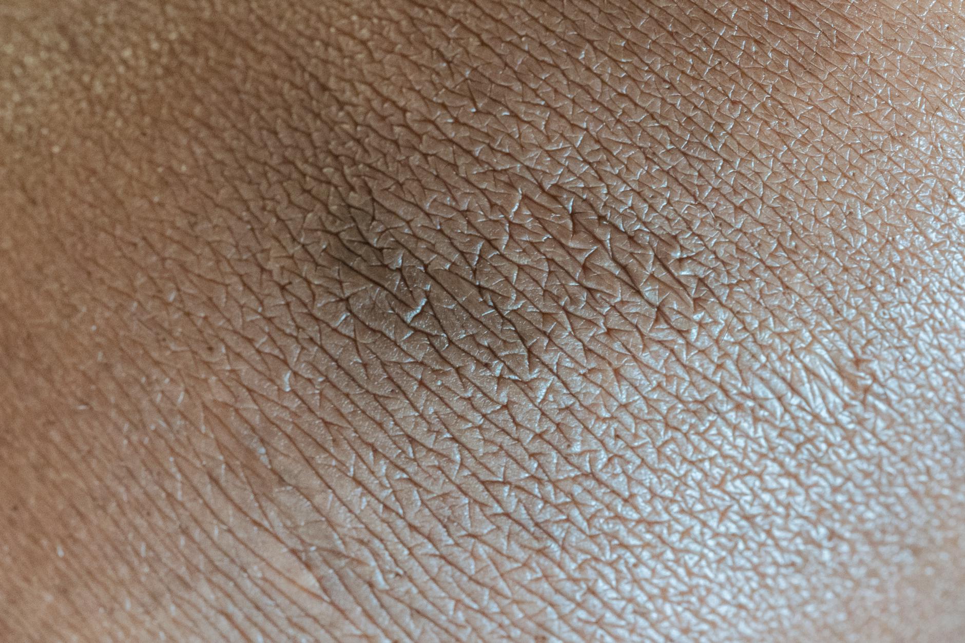 What Are the Symptoms of Pelvic Instability That Get Mistaken for Disc Problems?