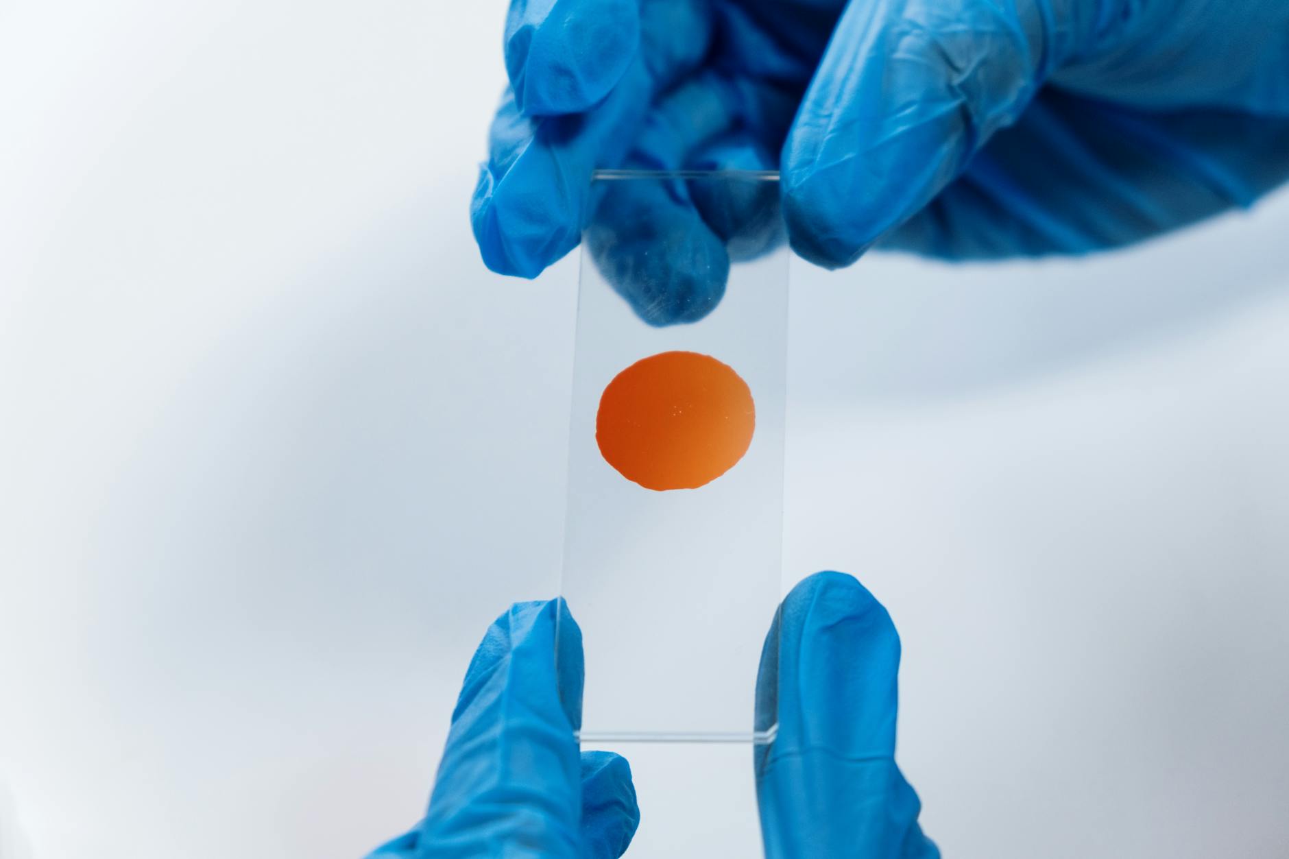 What Biomarkers Reveal About Alzheimer's in Olfactory Tissue