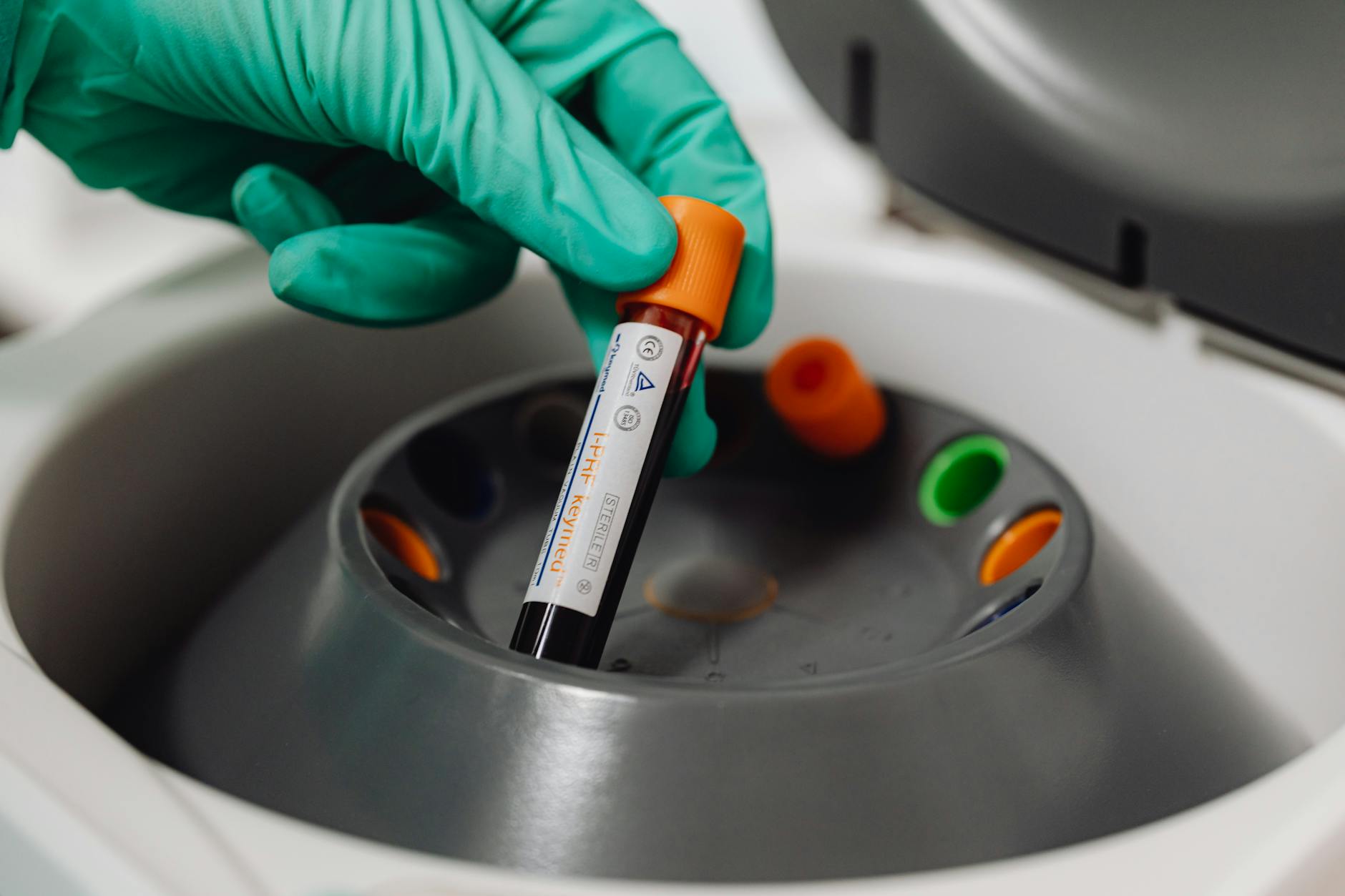 What Does the Blood Test Actually Measure and Predict?