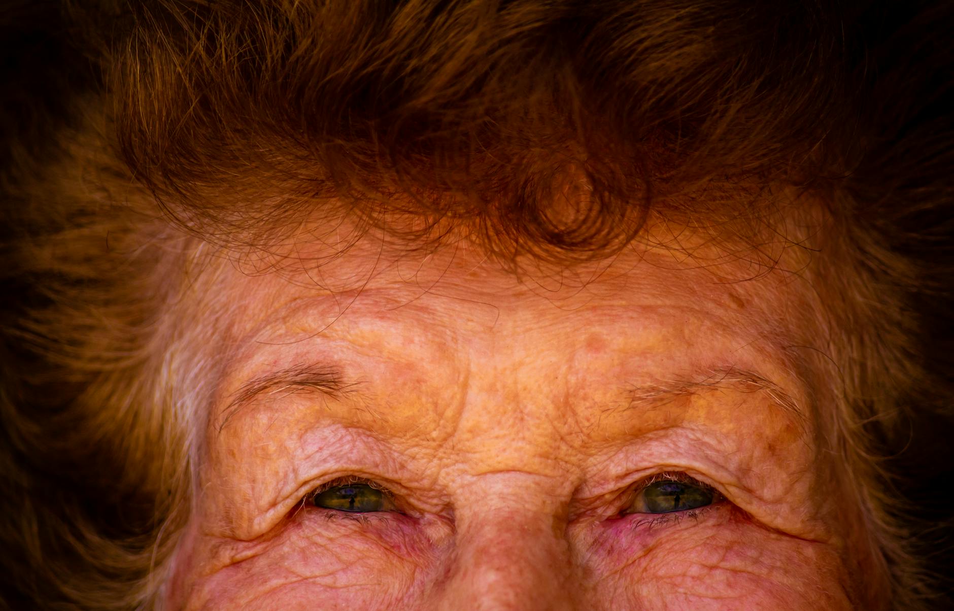 What Does the Current Alzheimer's Drug Pipeline Look Like?