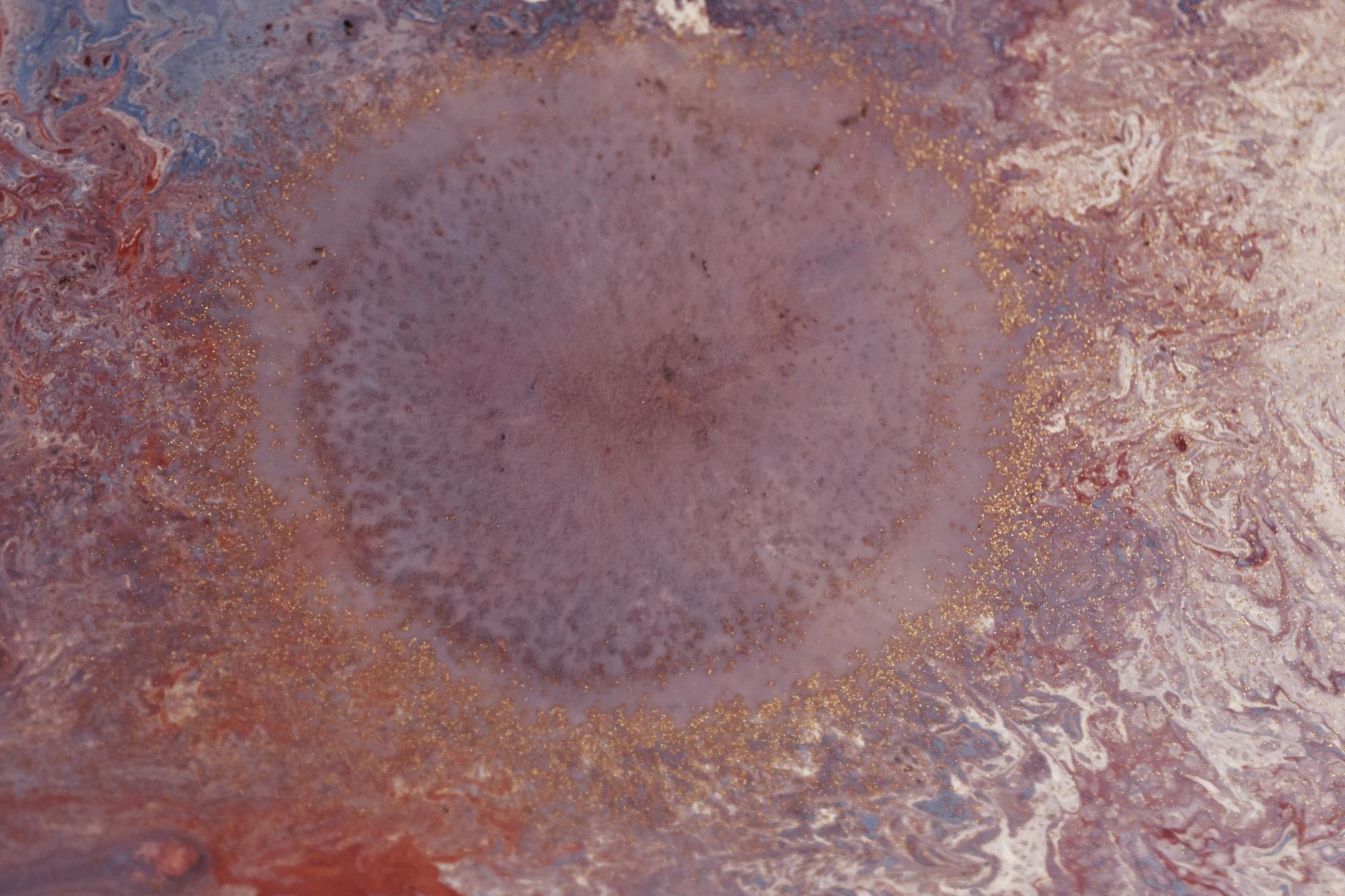What Is Autophagy and Why Does It Matter for Alzheimer's Disease?