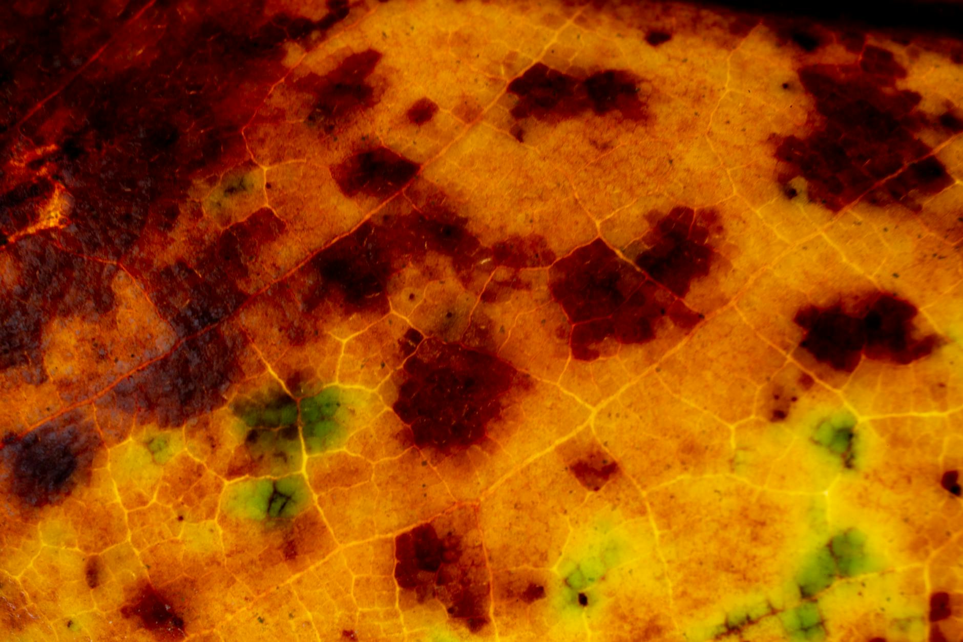 What Is Hyperkeratosis and How Does It Change Your Skin's Texture?