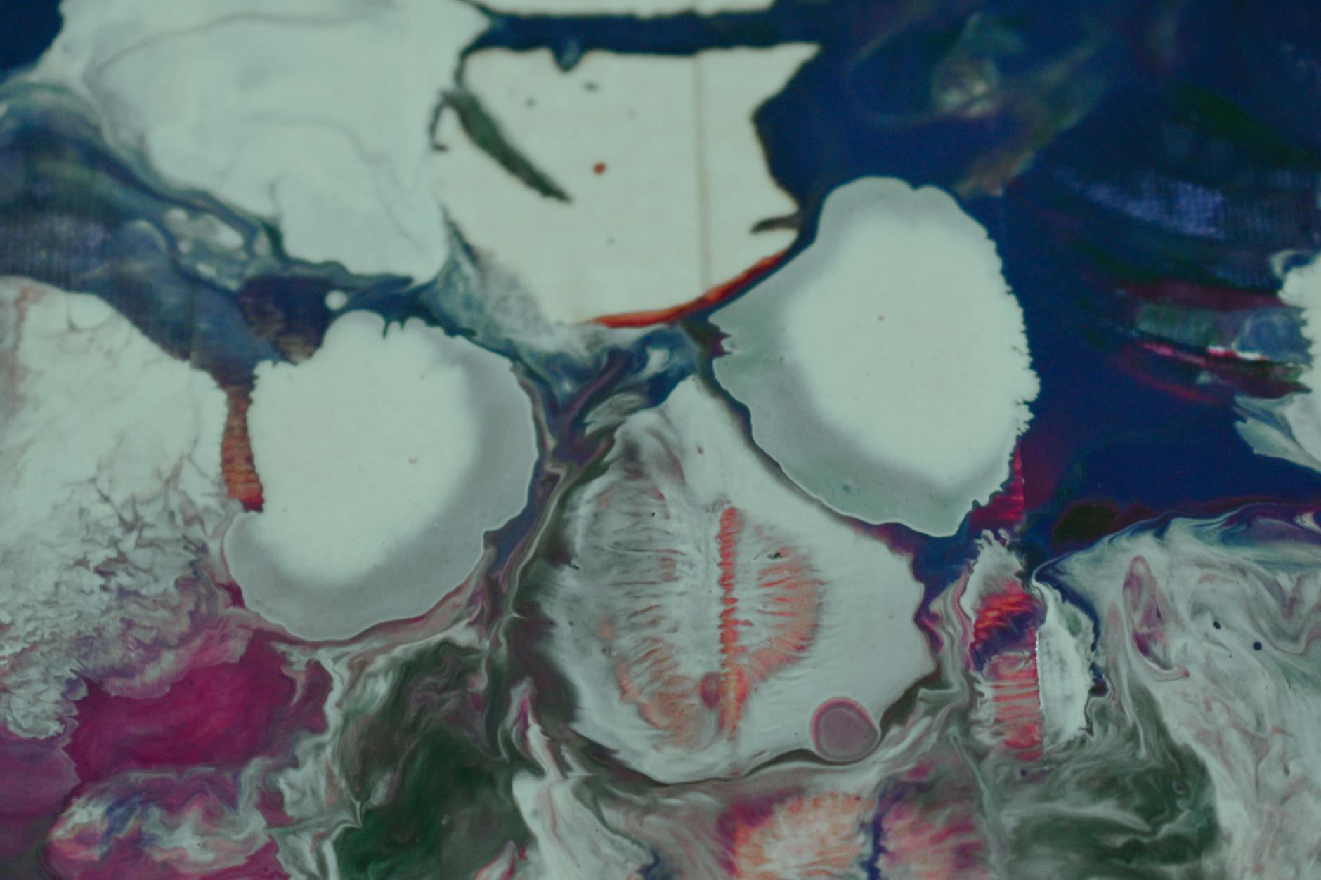 What Is Olfactory Cleft Biopsy and How Does It Reveal Alzheimer's Pathology?