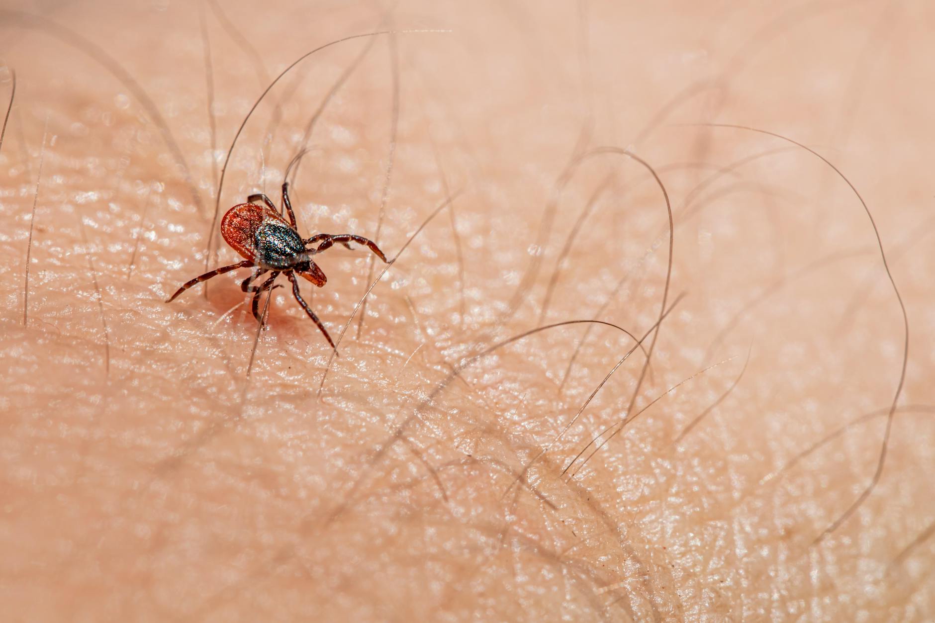 What Is the New Lyme Disease Vaccine in Clinical Trials and How Does It Work?
