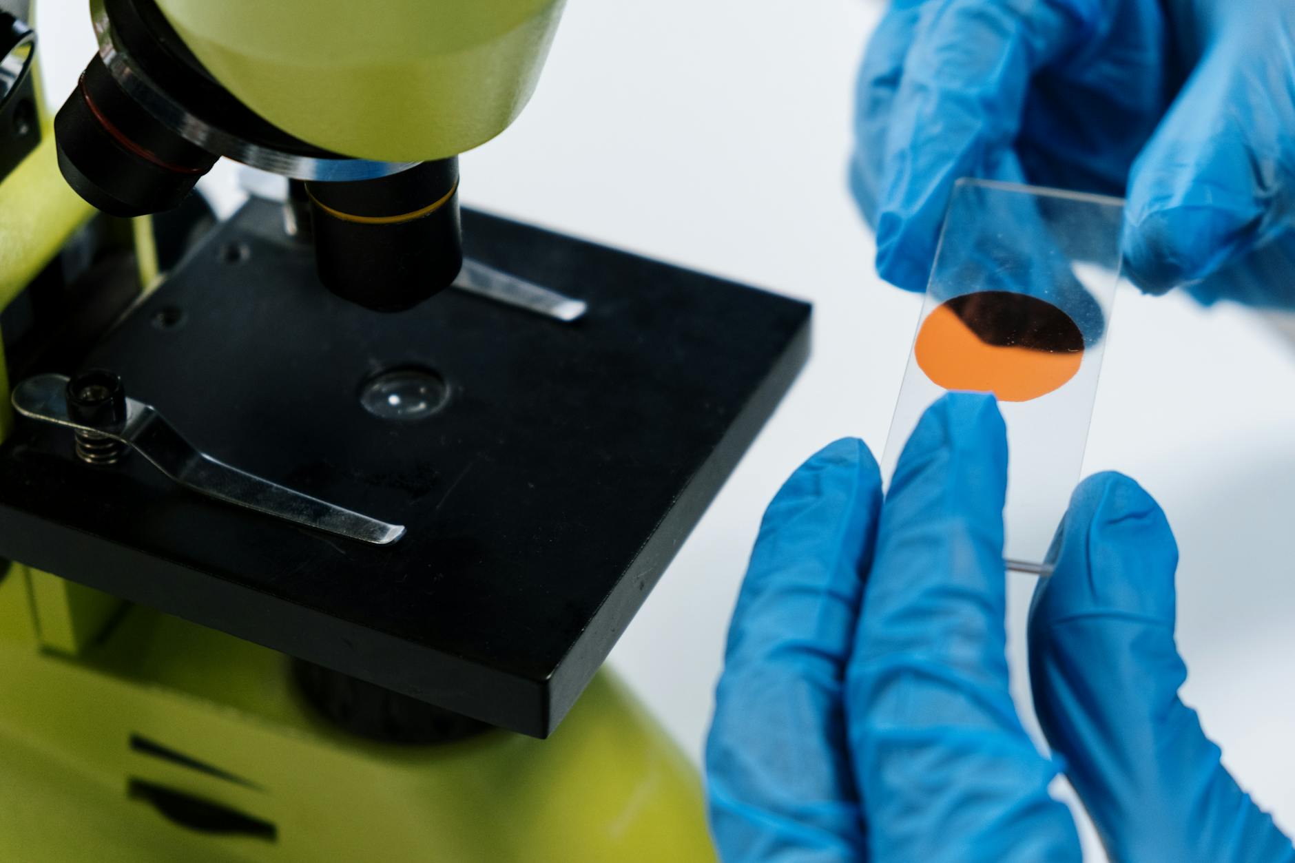 What Recent Research Reveals About Natural Compounds and Alzheimer's Progression