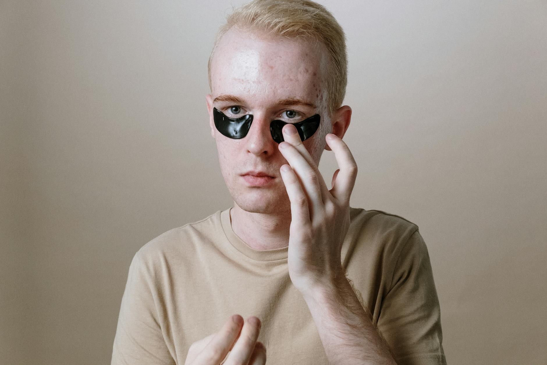 What Types of Acne Does LED Therapy Treat?