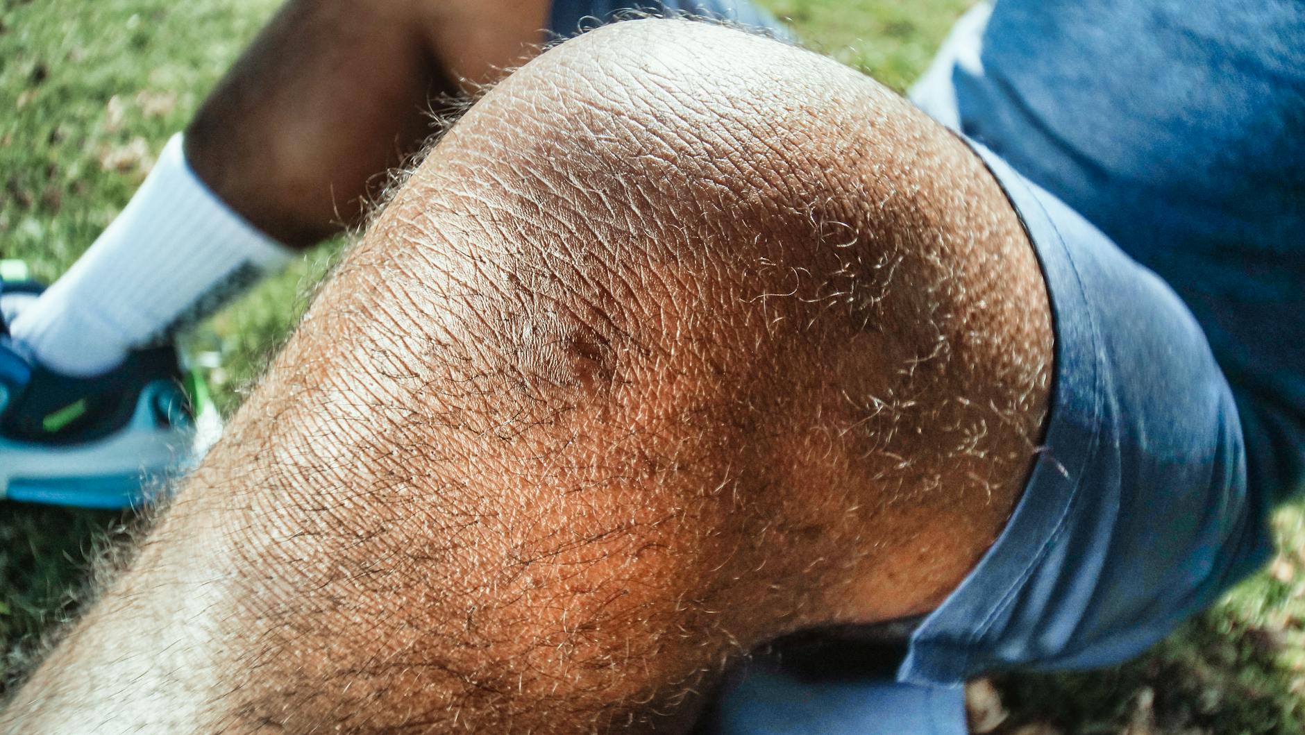 Why Do SI Joint Dysfunction and Disc Herniation Produce Similar Symptoms?