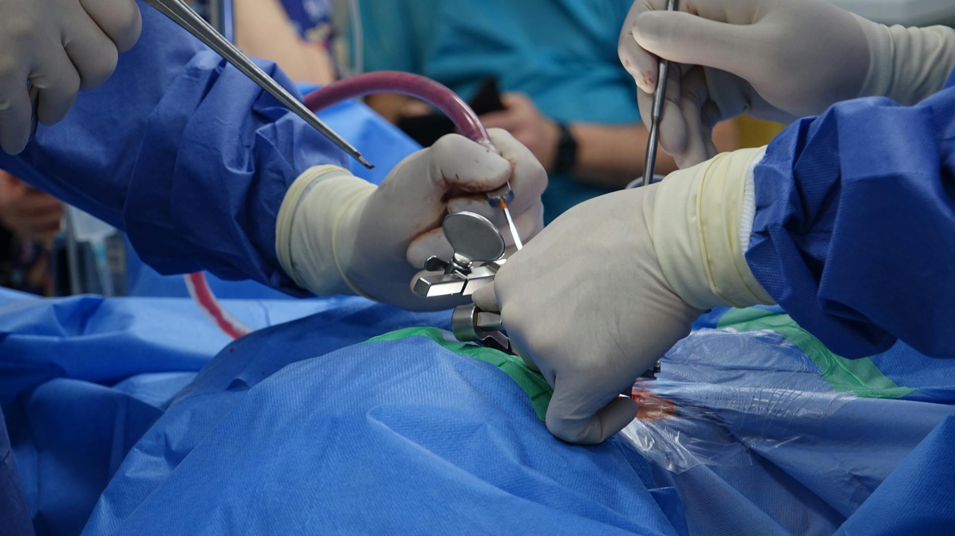 Why Do Spinal Discs Lose Water Content With Age?