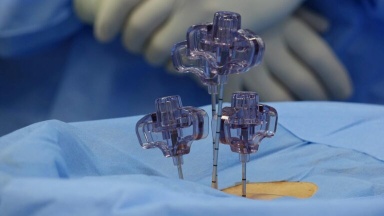 Why Herniated Discs Cause Sudden Sharp Pain - Featured image